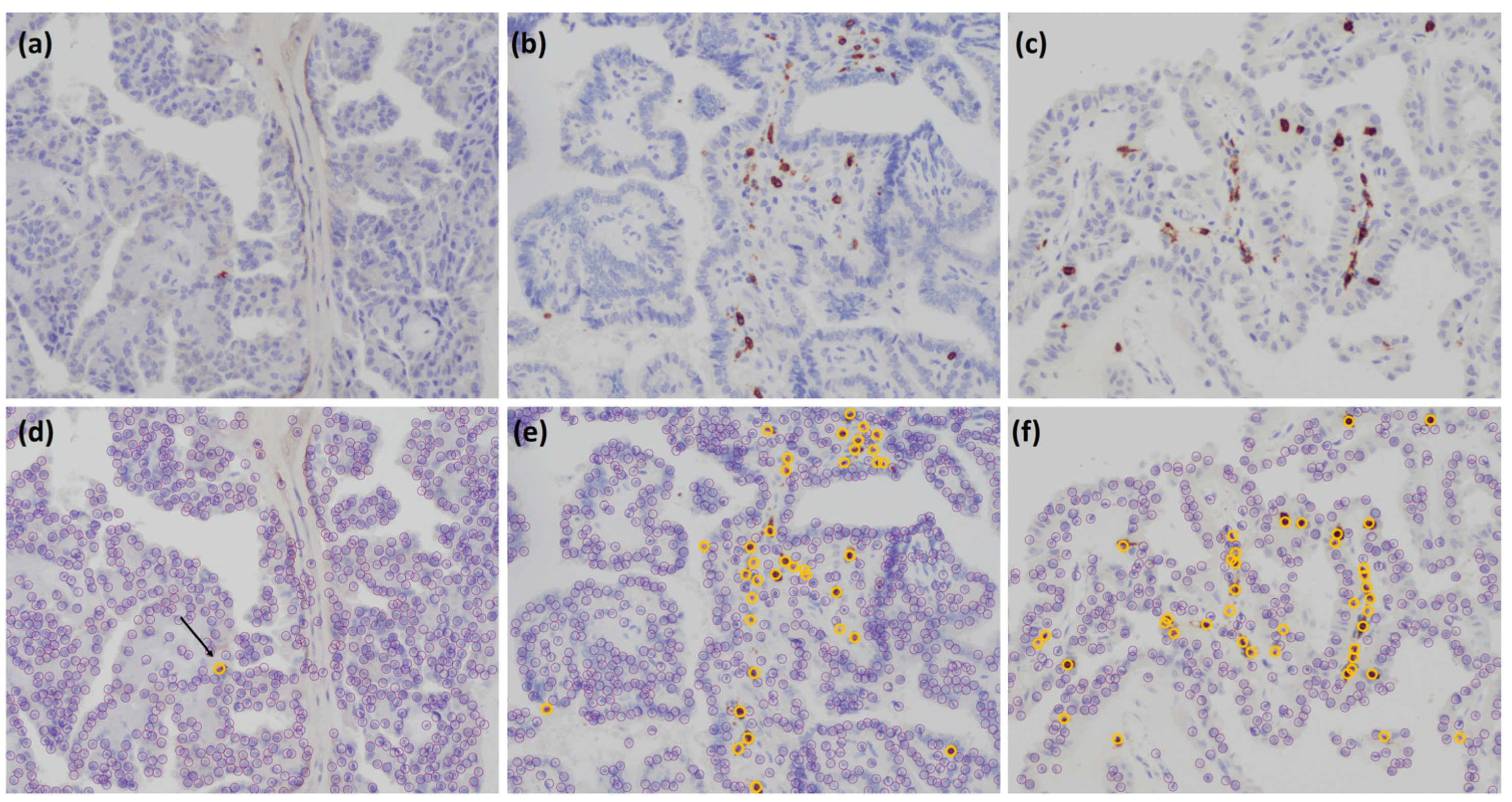 Cancers 15 03449 g002 Cancers 15 03449 g002