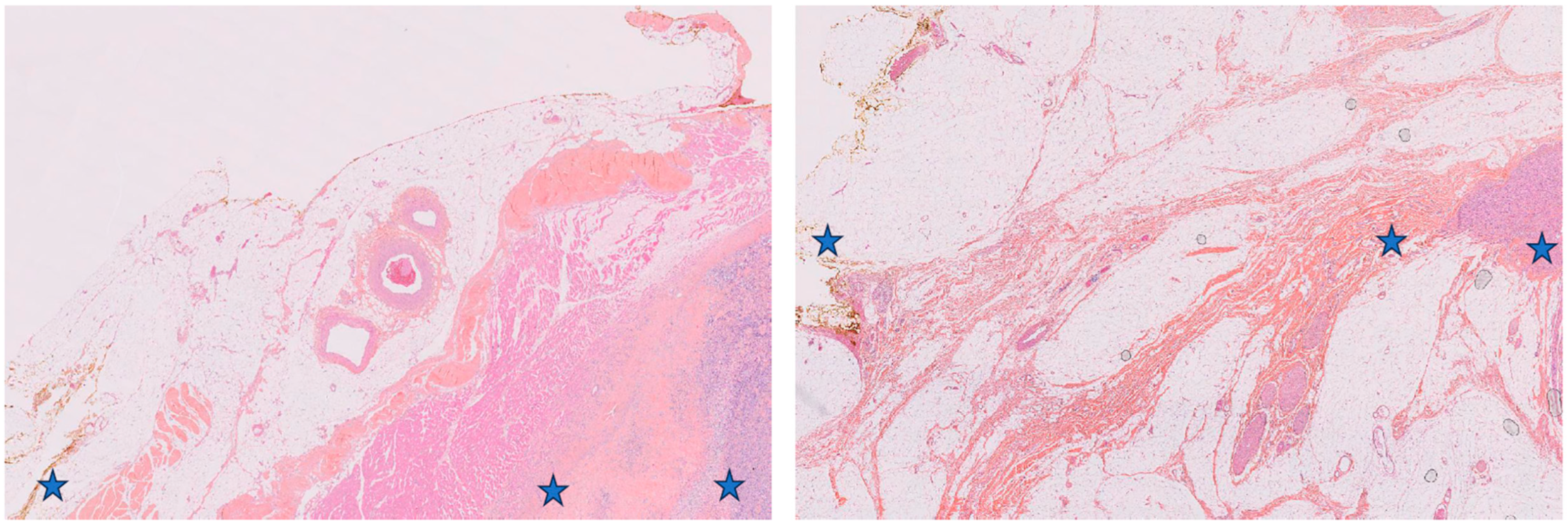 Cancers 15 03450 g001