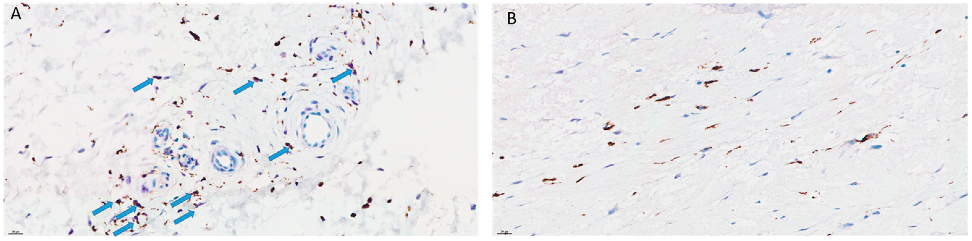 Cancers 15 03450 g009