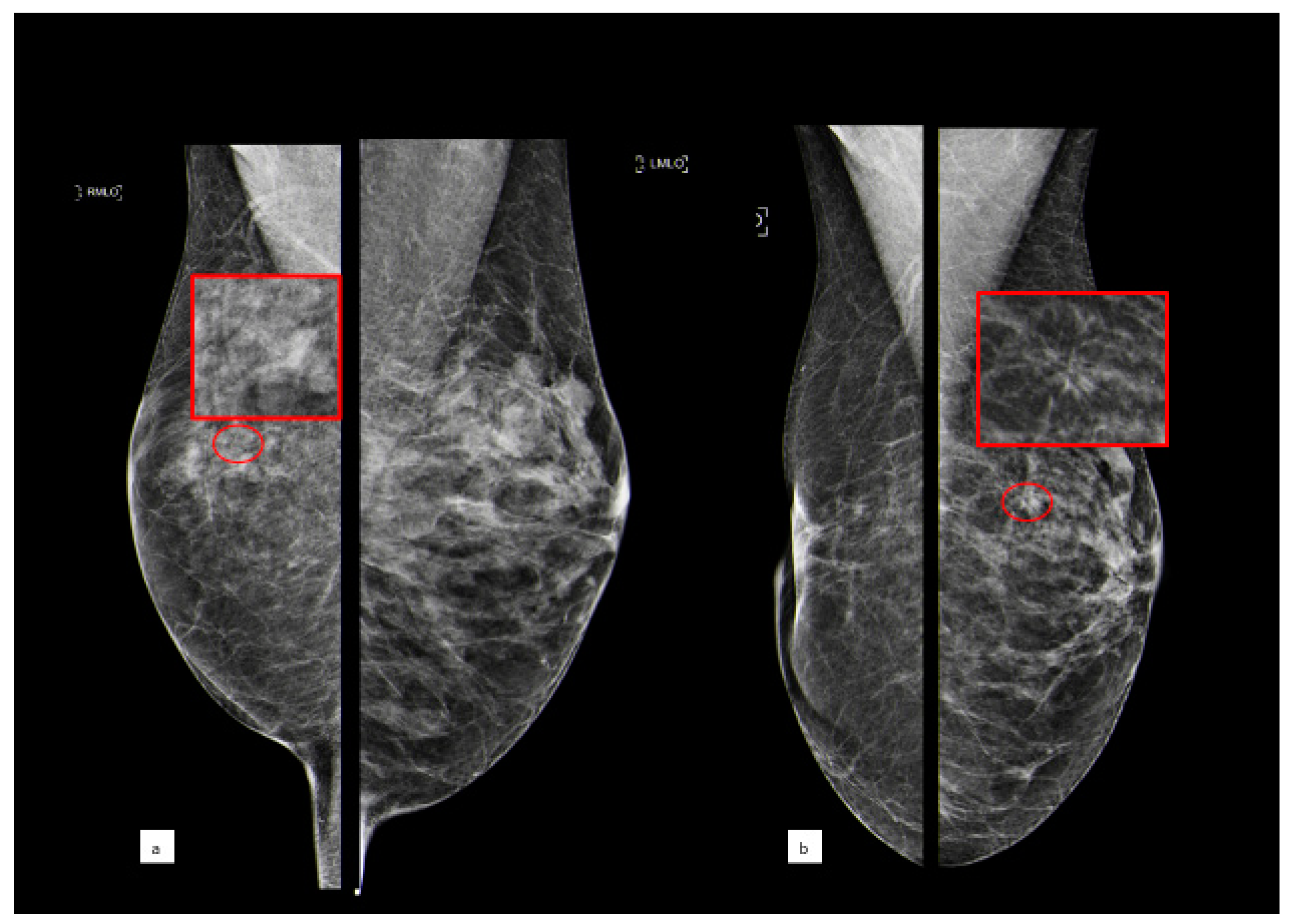 Cancers 15 03521 g002