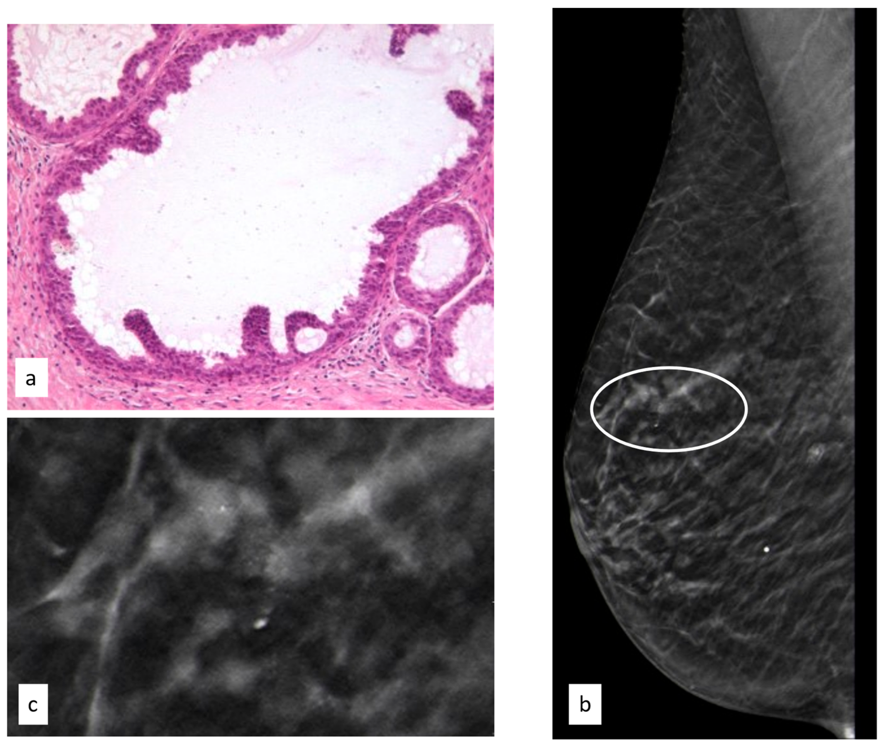 Cancers 15 03521 g004