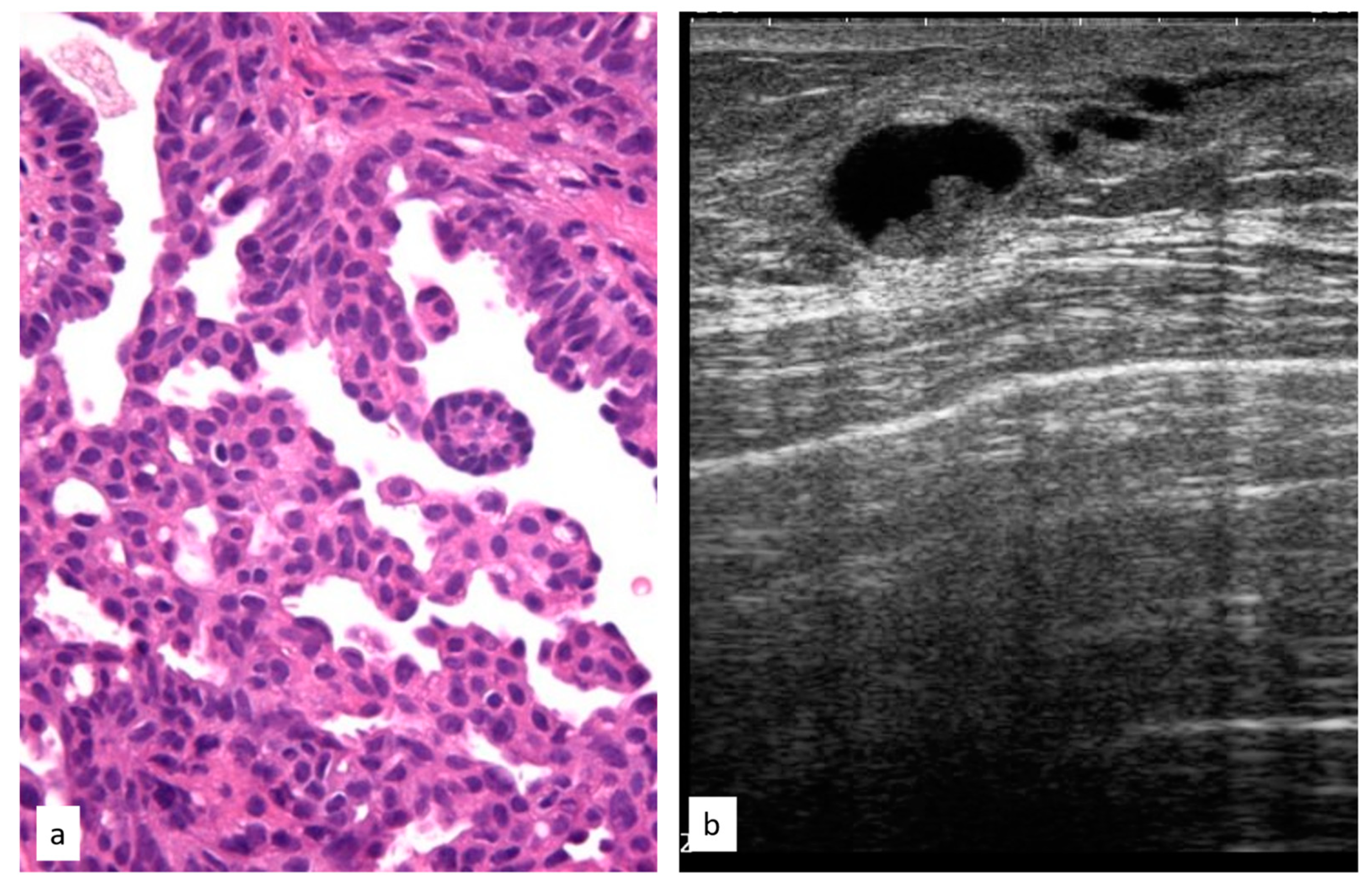 Cancers 15 03521 g006