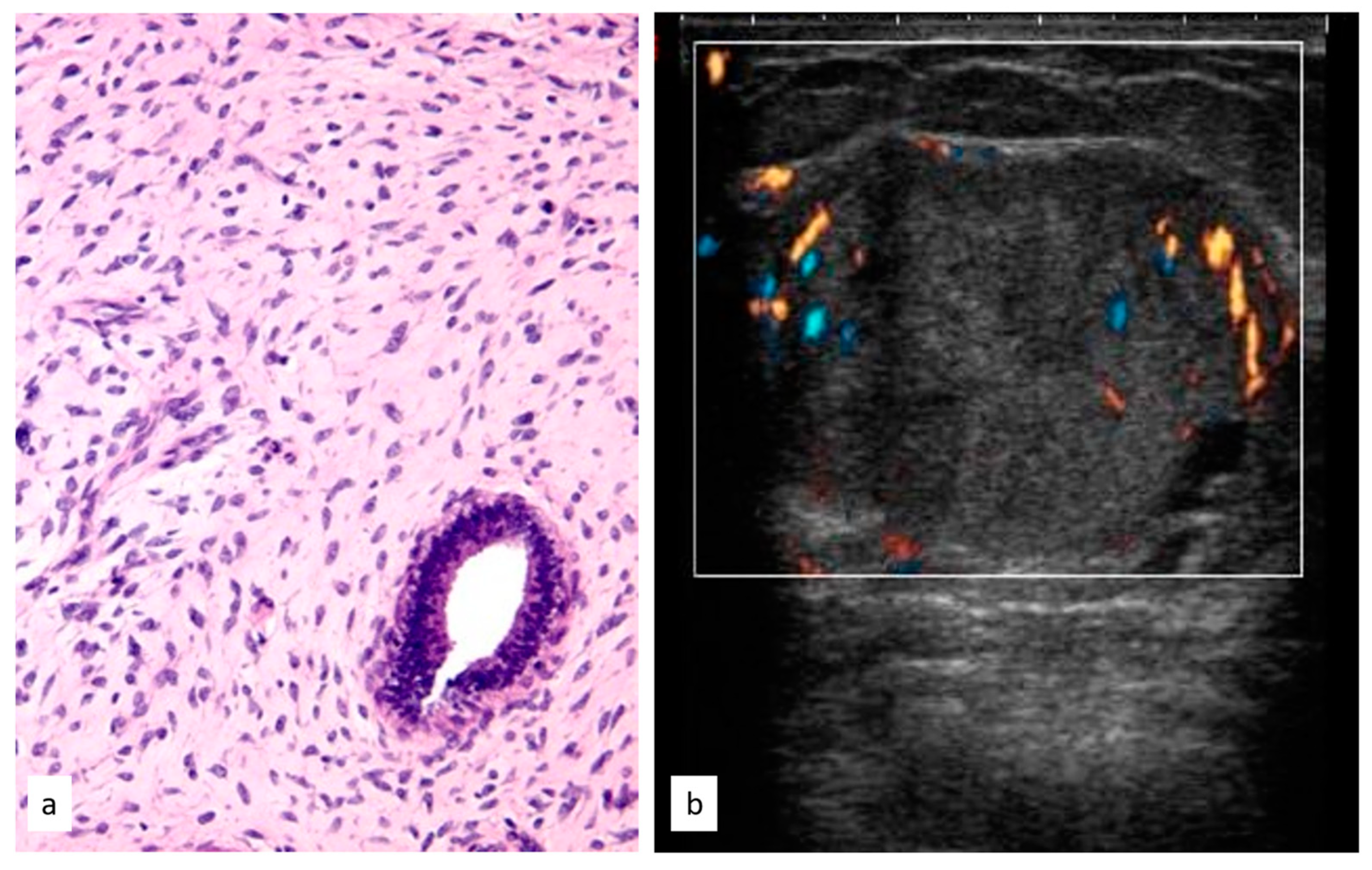 Cancers 15 03521 g007