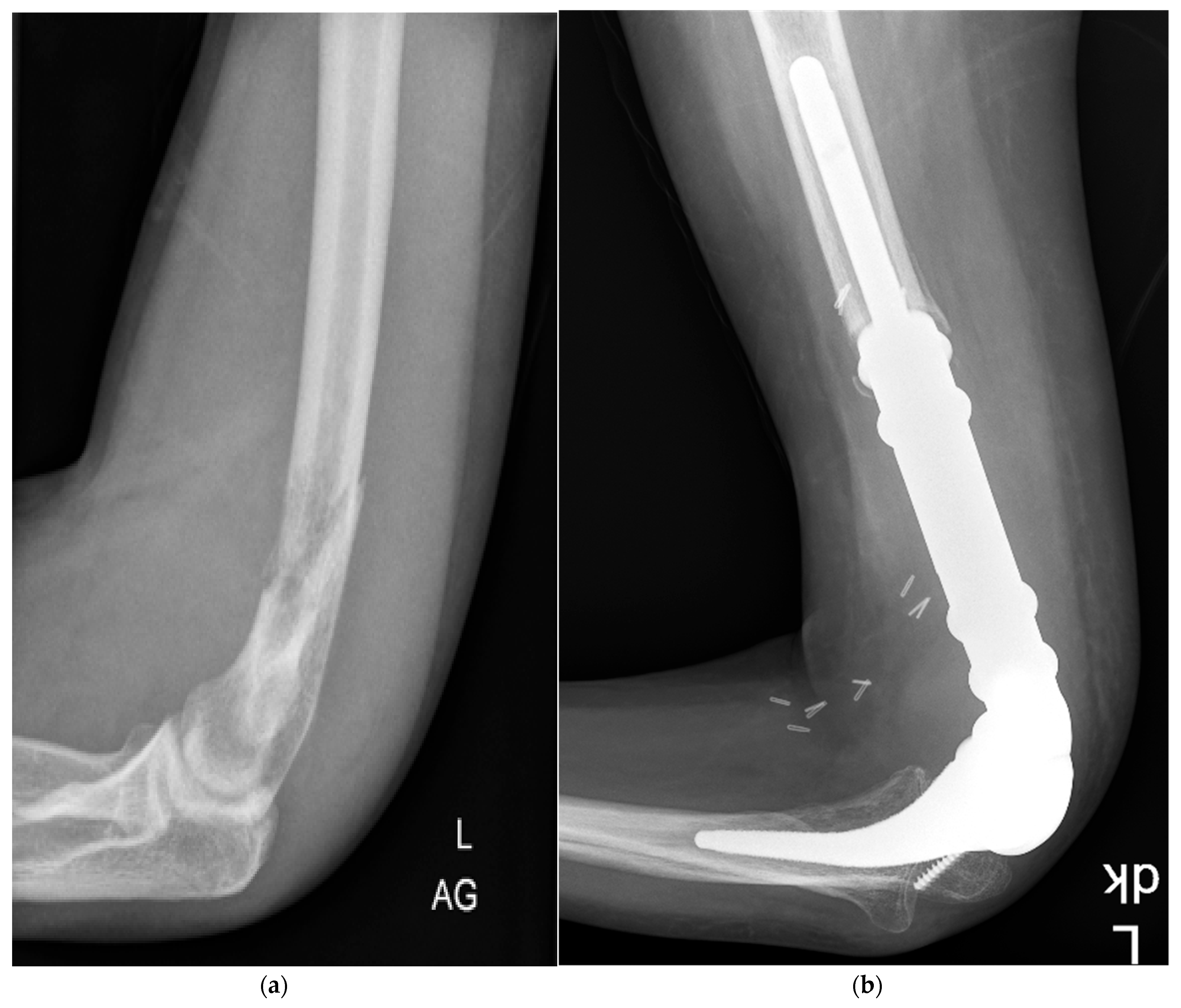 Cancers 15 03534 g002 Cancers 15 03534 g002