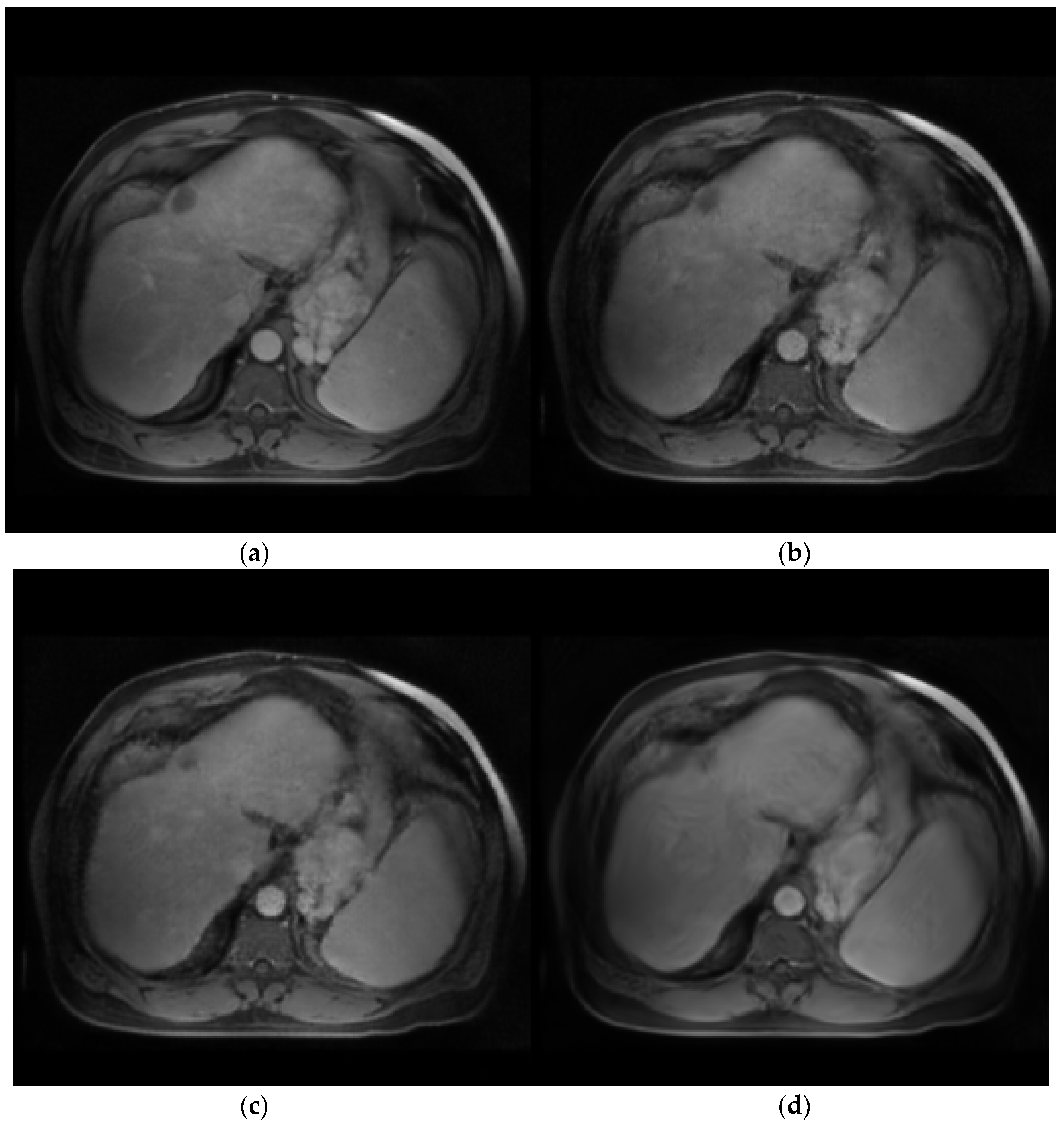 Cancers 15 03544 g004 Cancers 15 03544 g004