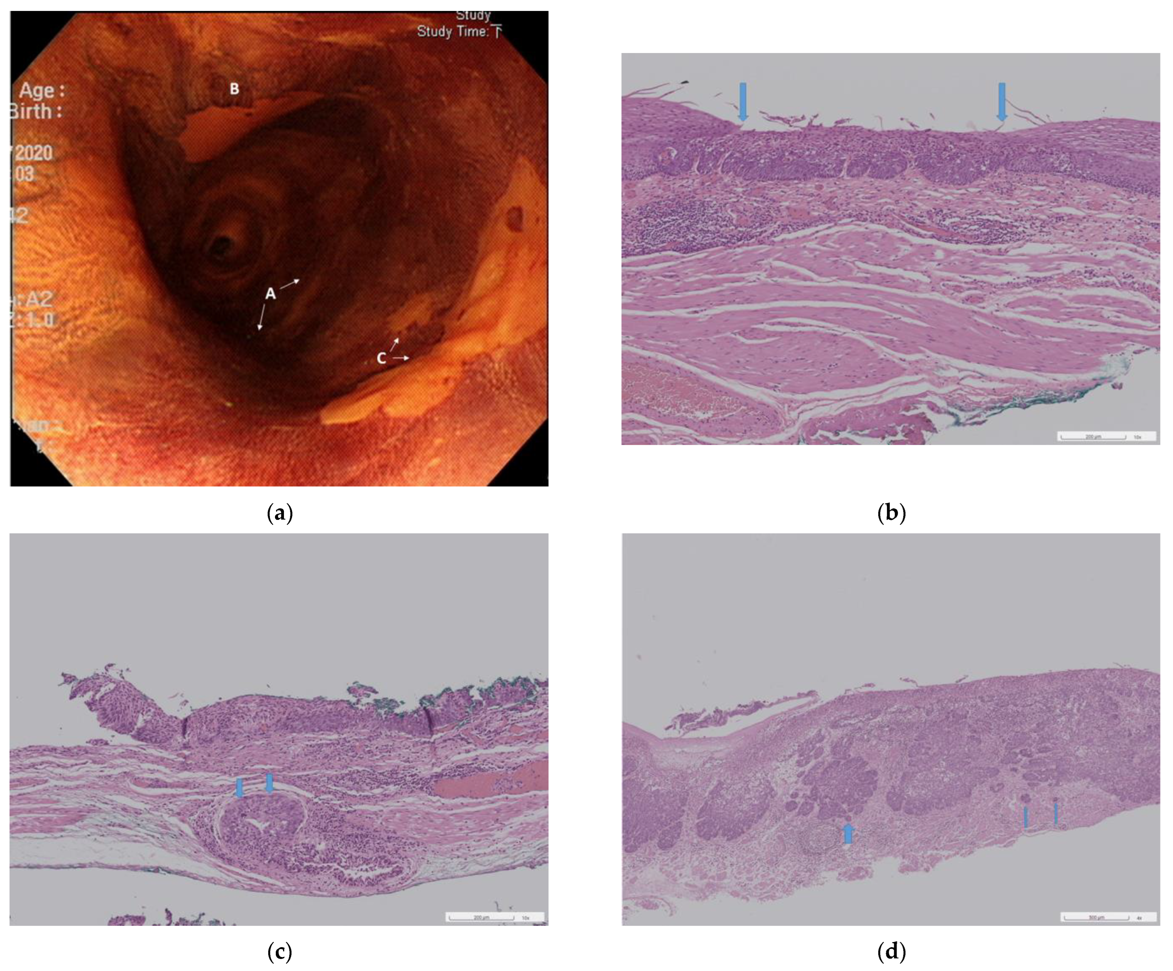 Cancers 15 03558 g002