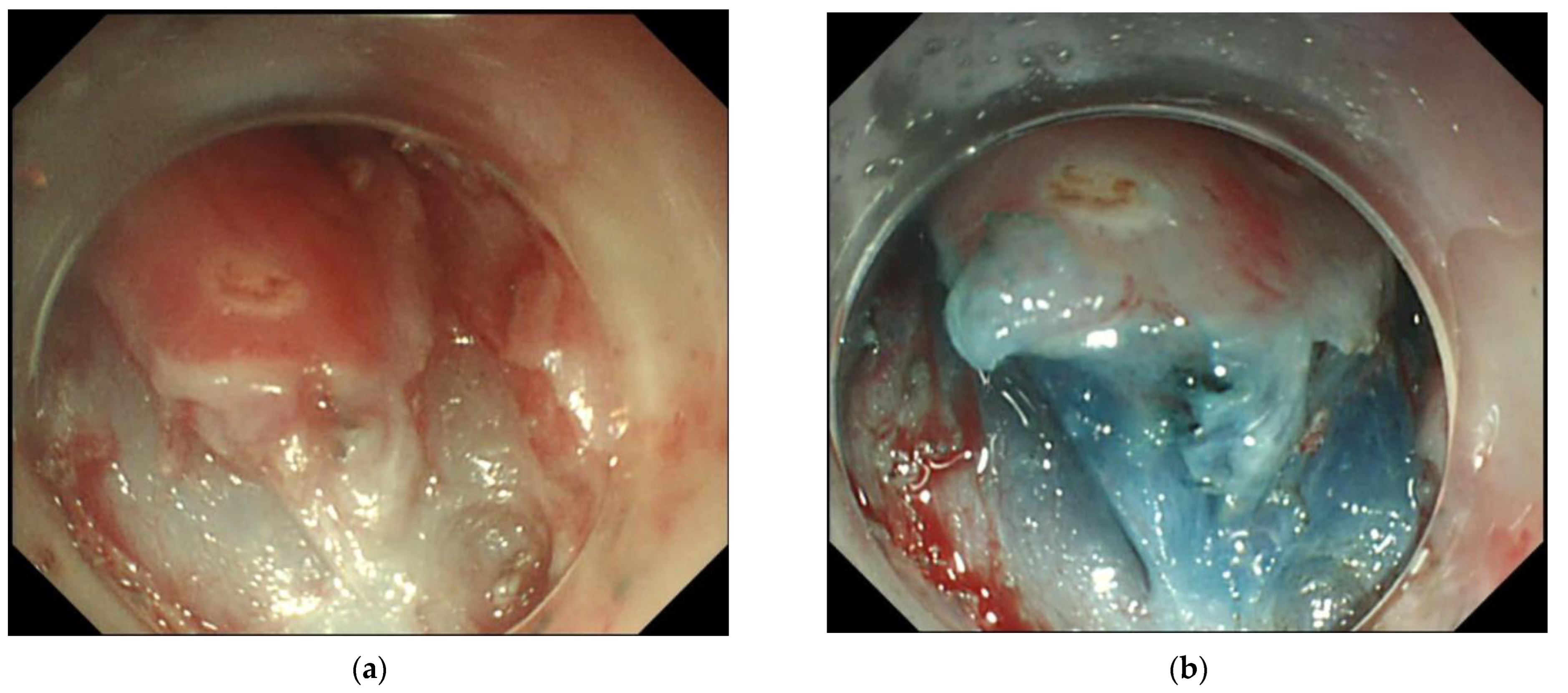 Cancers 15 03558 g003