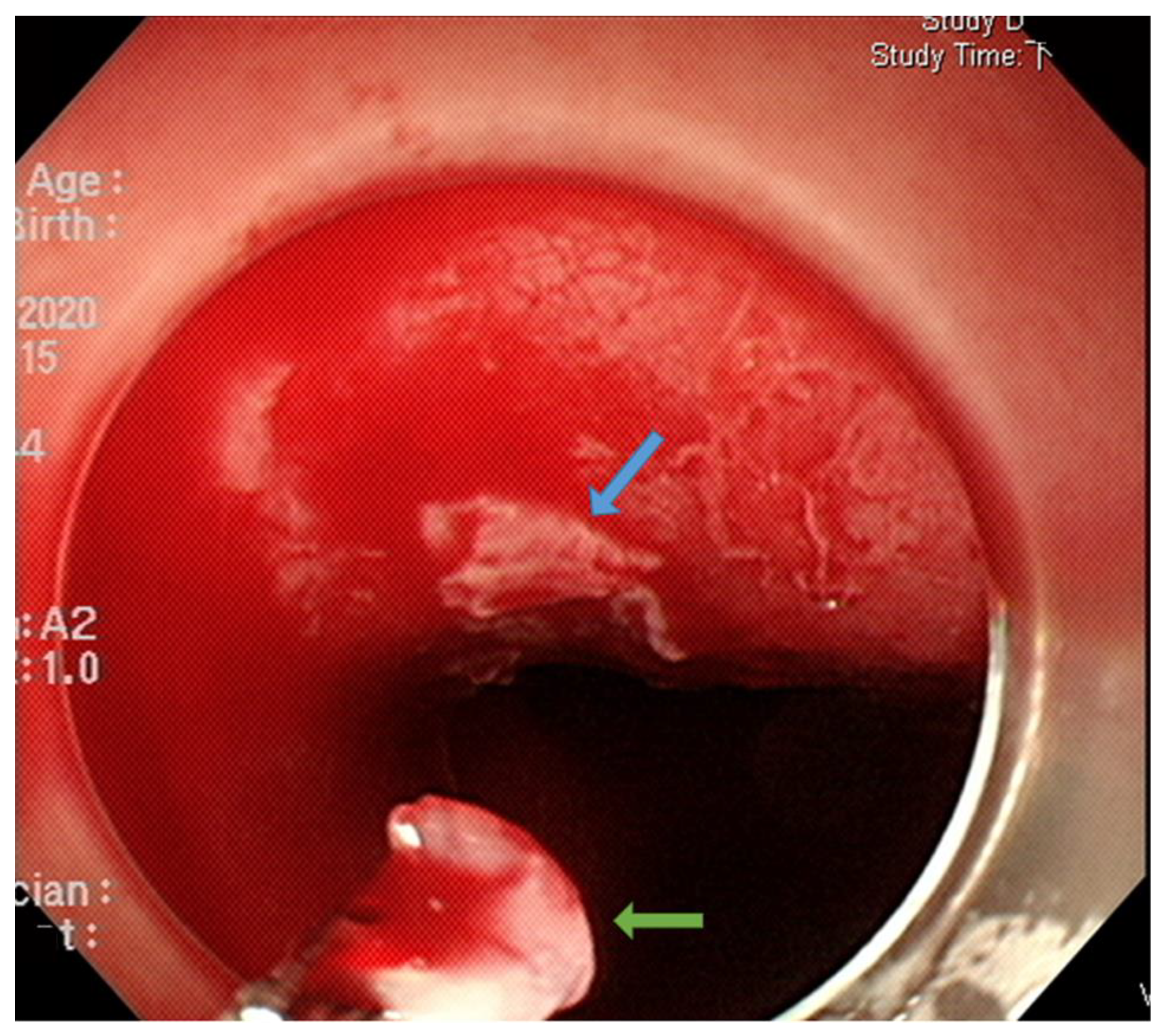 Cancers 15 03558 g004