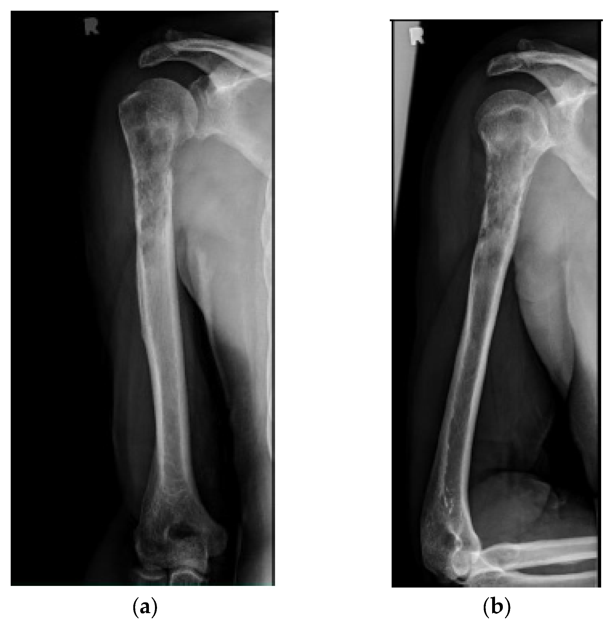 Cancers 15 03601 g002a Cancers 15 03601 g002a