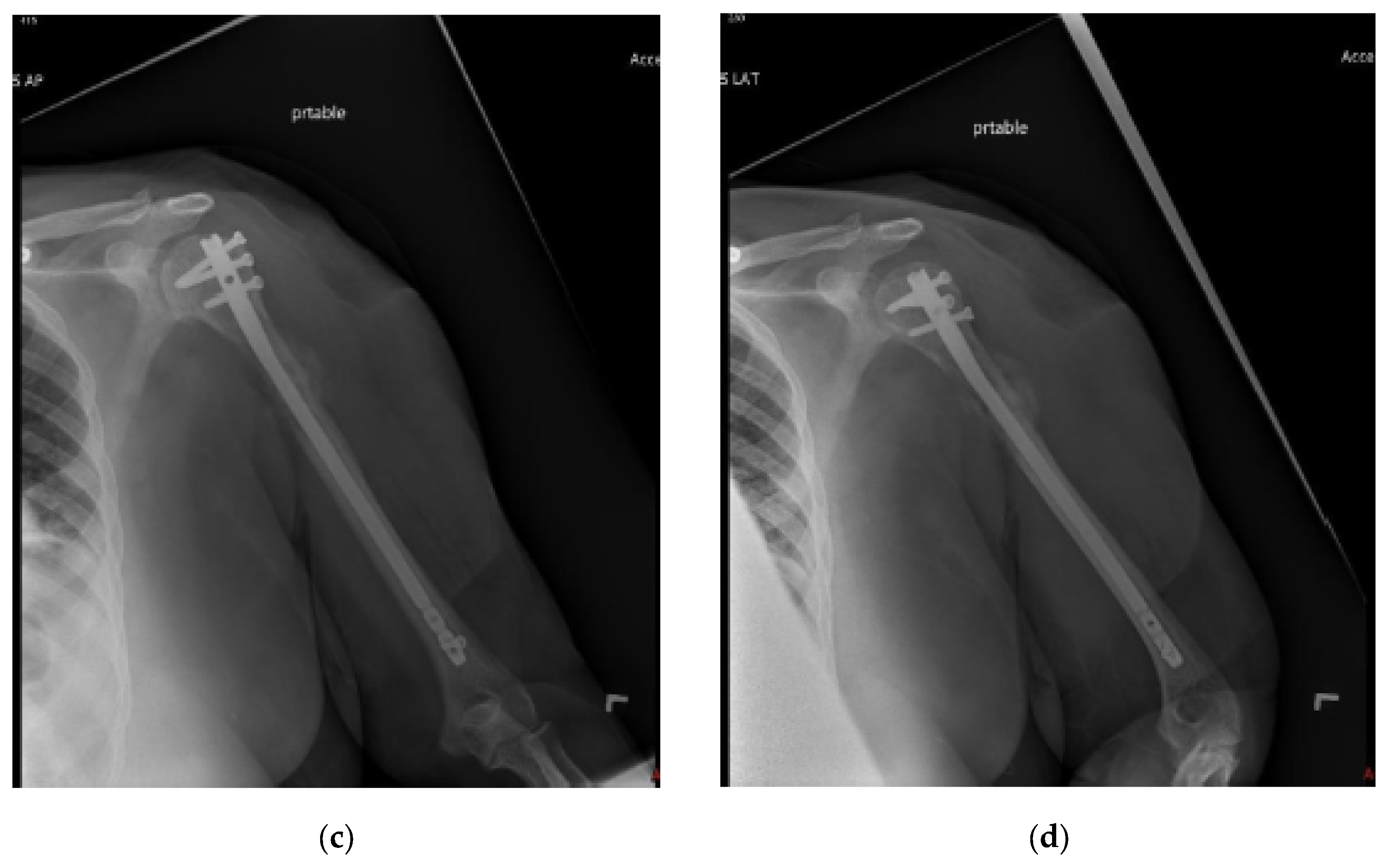 Cancers 15 03601 g003b Cancers 15 03601 g003b