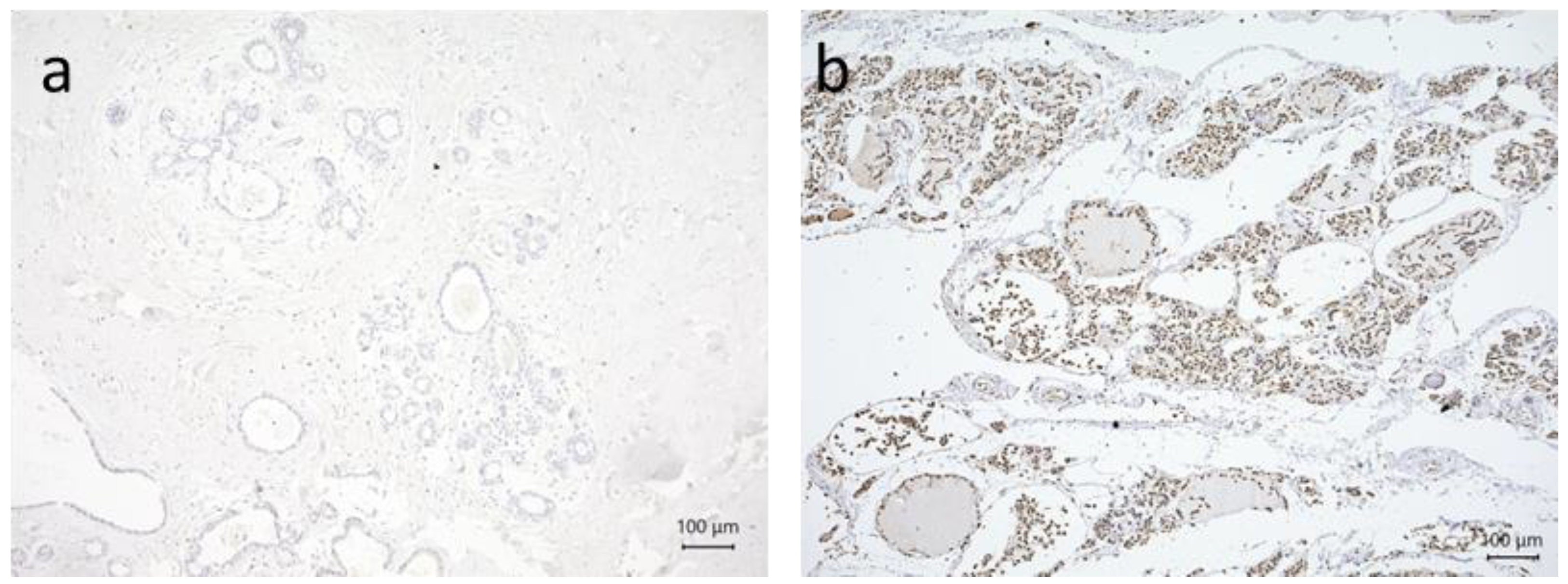 Cancers 15 03610 g001