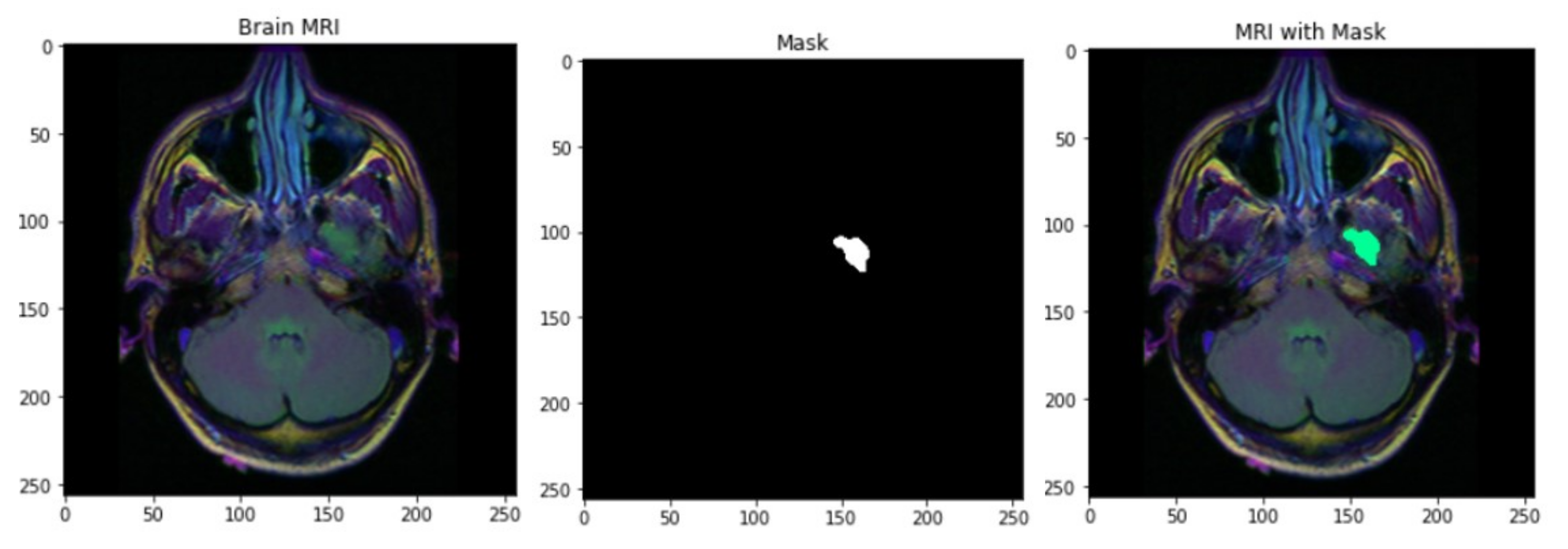 Cancers 15 03614 g001 Cancers 15 03614 g001