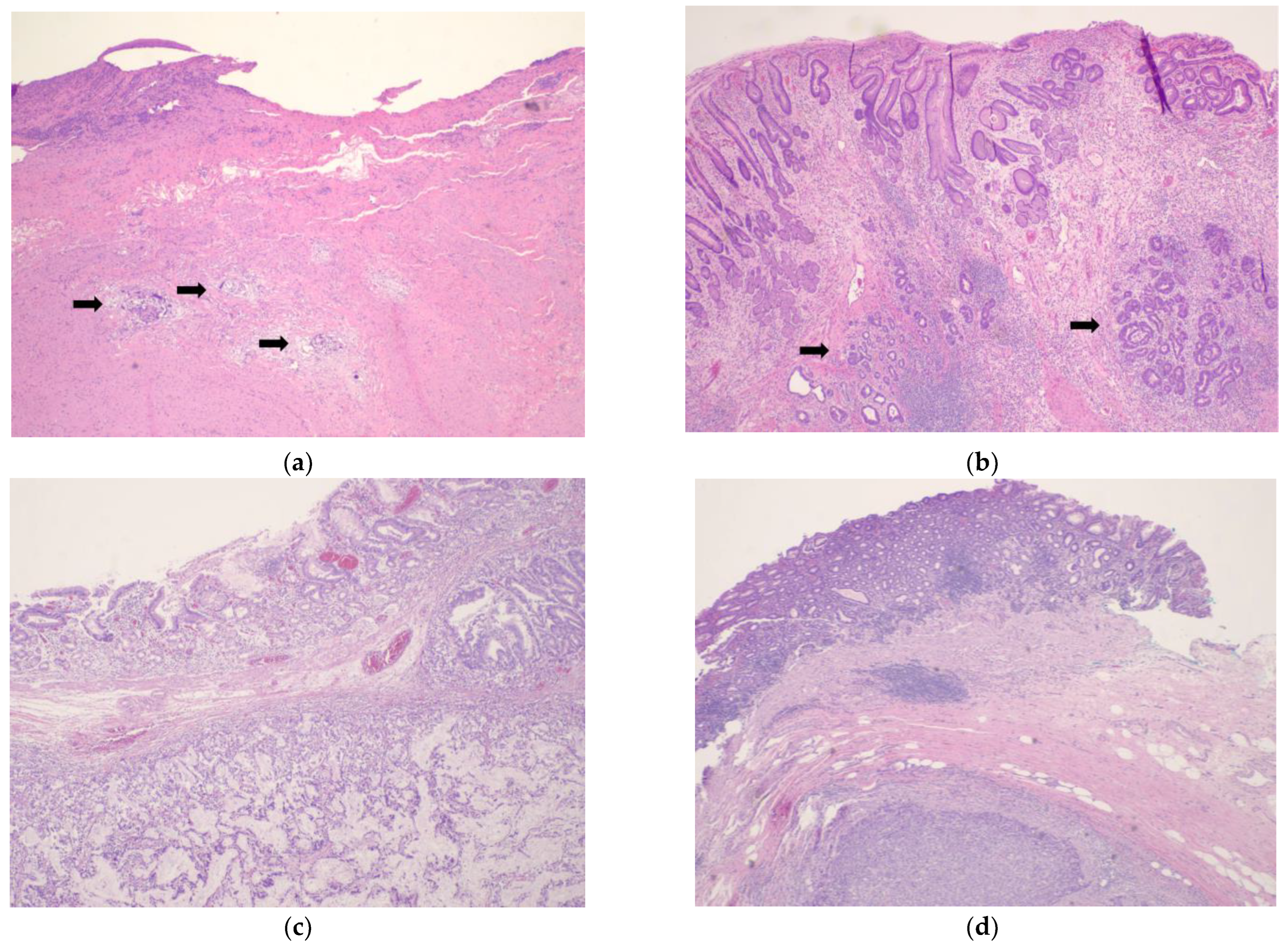 Cancers 15 03662 g001 Cancers 15 03662 g001