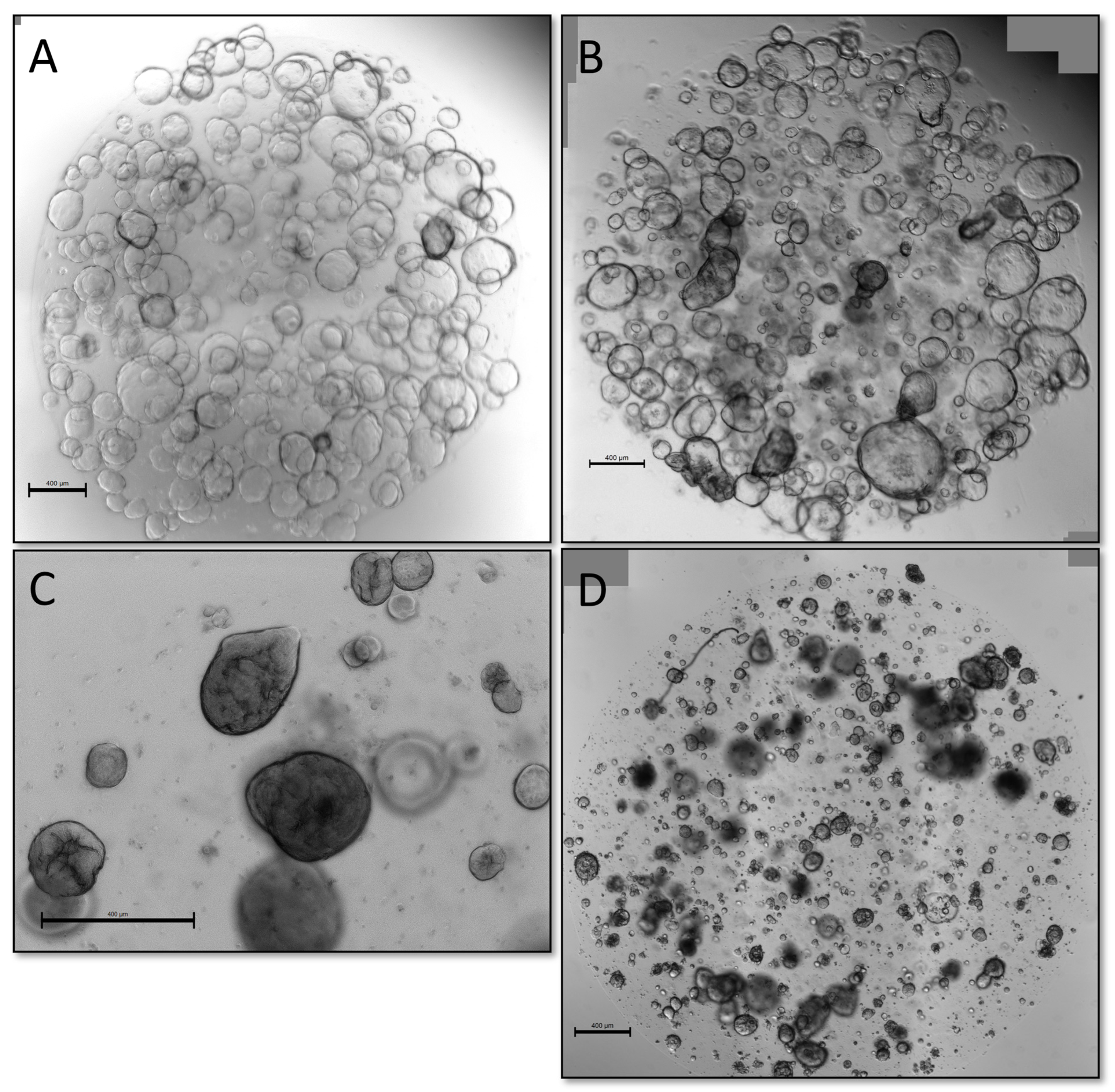 Cancers 15 03677 g004