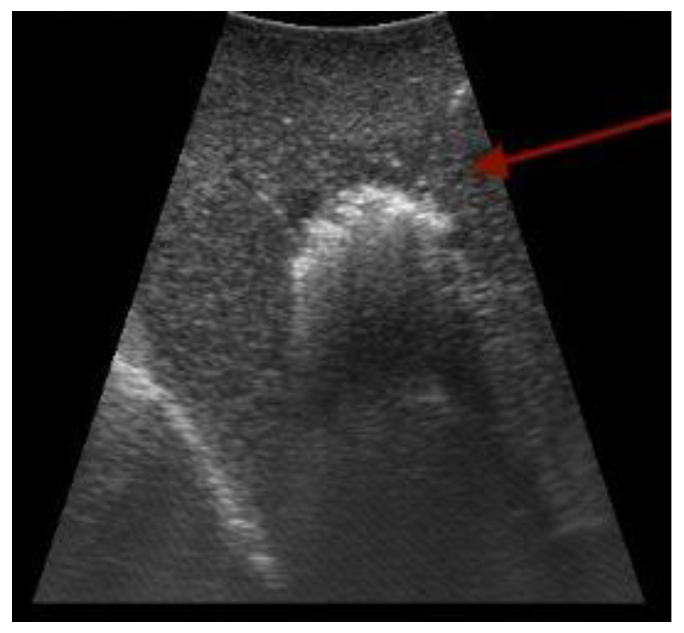 Cancers 15 03694 g003 Cancers 15 03694 g003