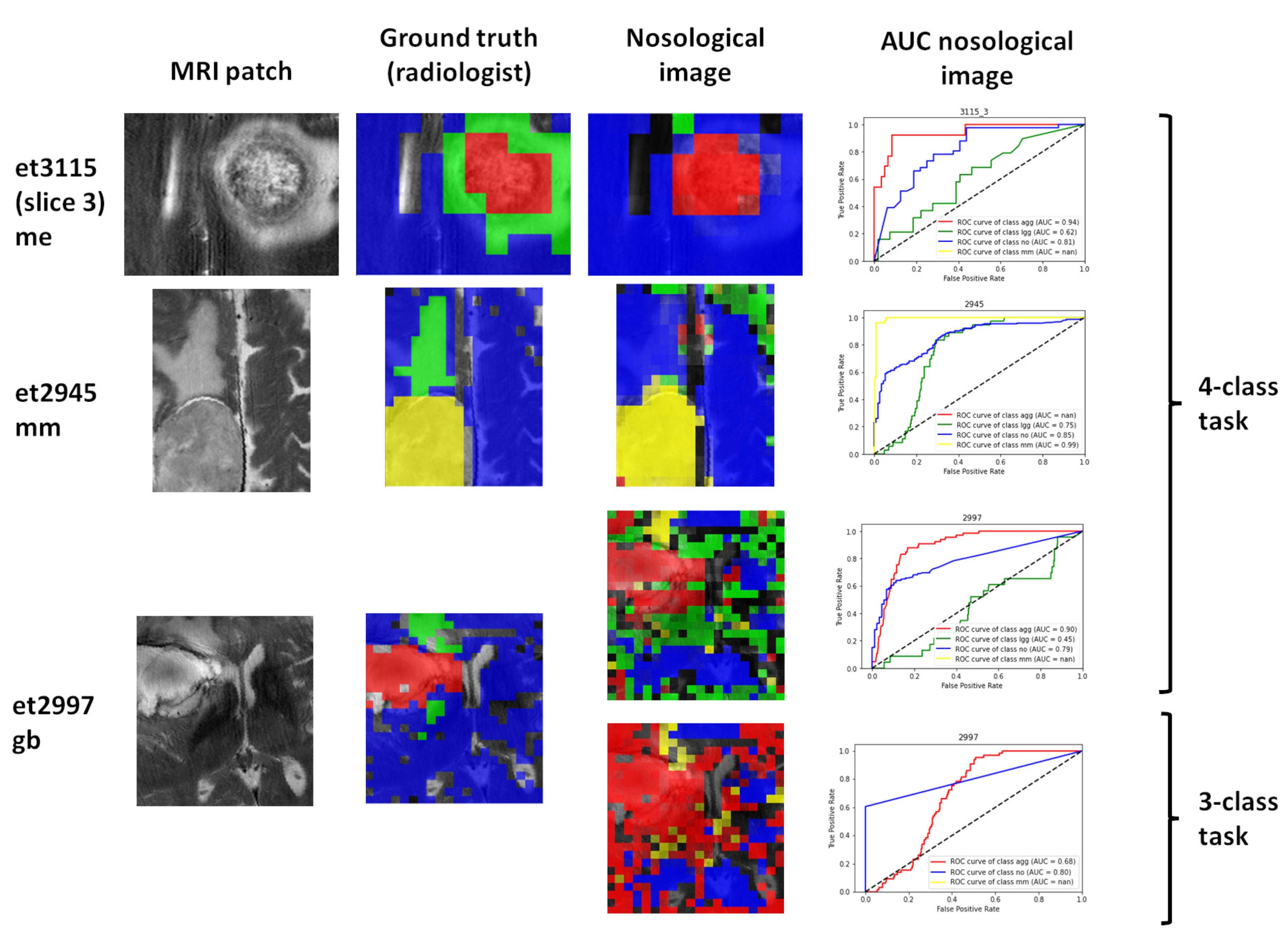 Cancers 15 03709 g005 Cancers 15 03709 g005