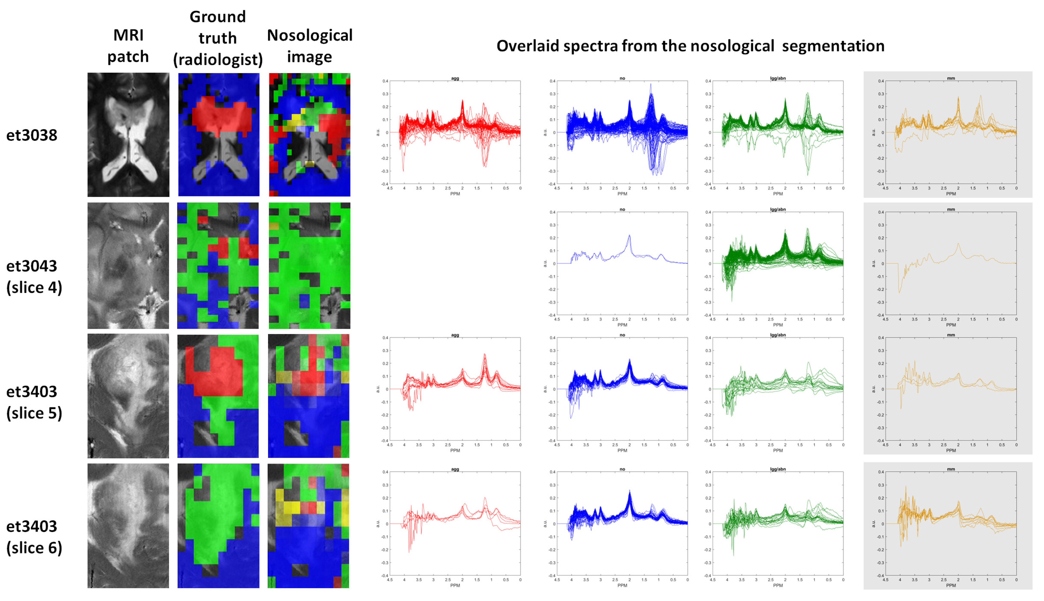 Cancers 15 03709 g008 Cancers 15 03709 g008