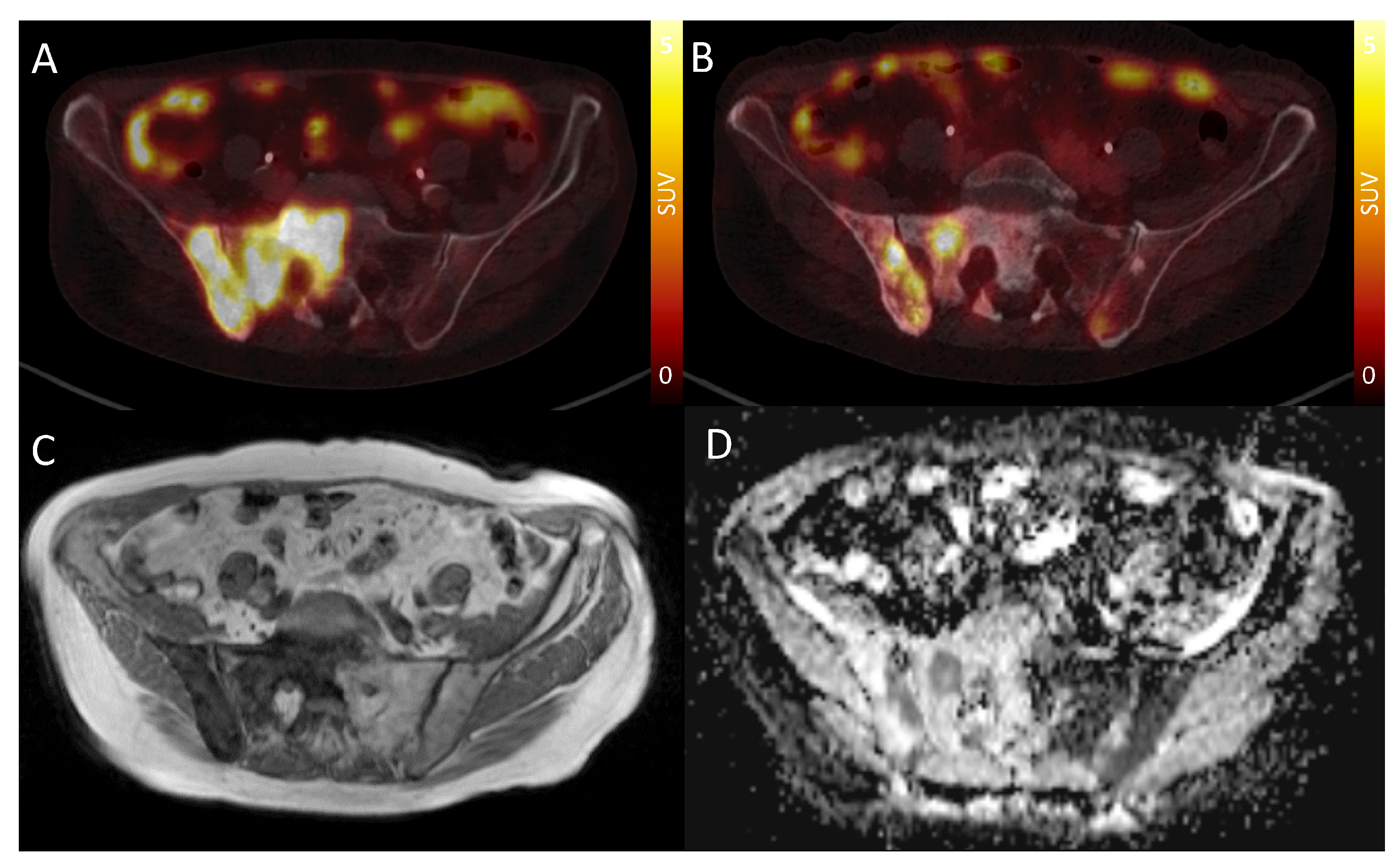 Cancers 15 03757 g002