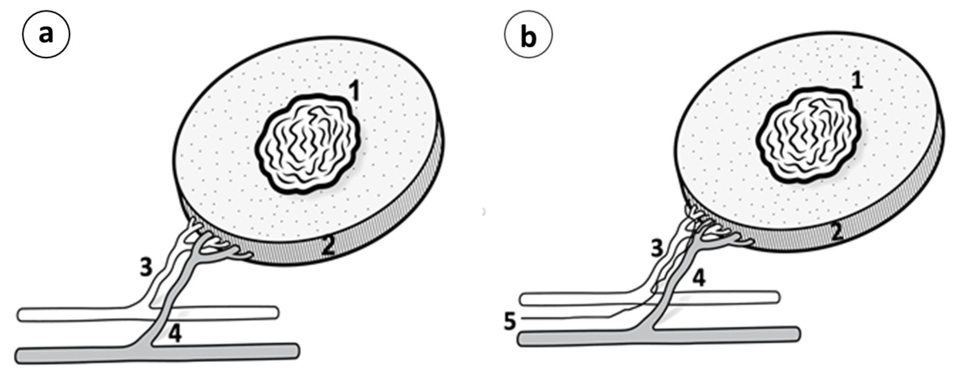 Cancers 15 03758 g005 Cancers 15 03758 g005