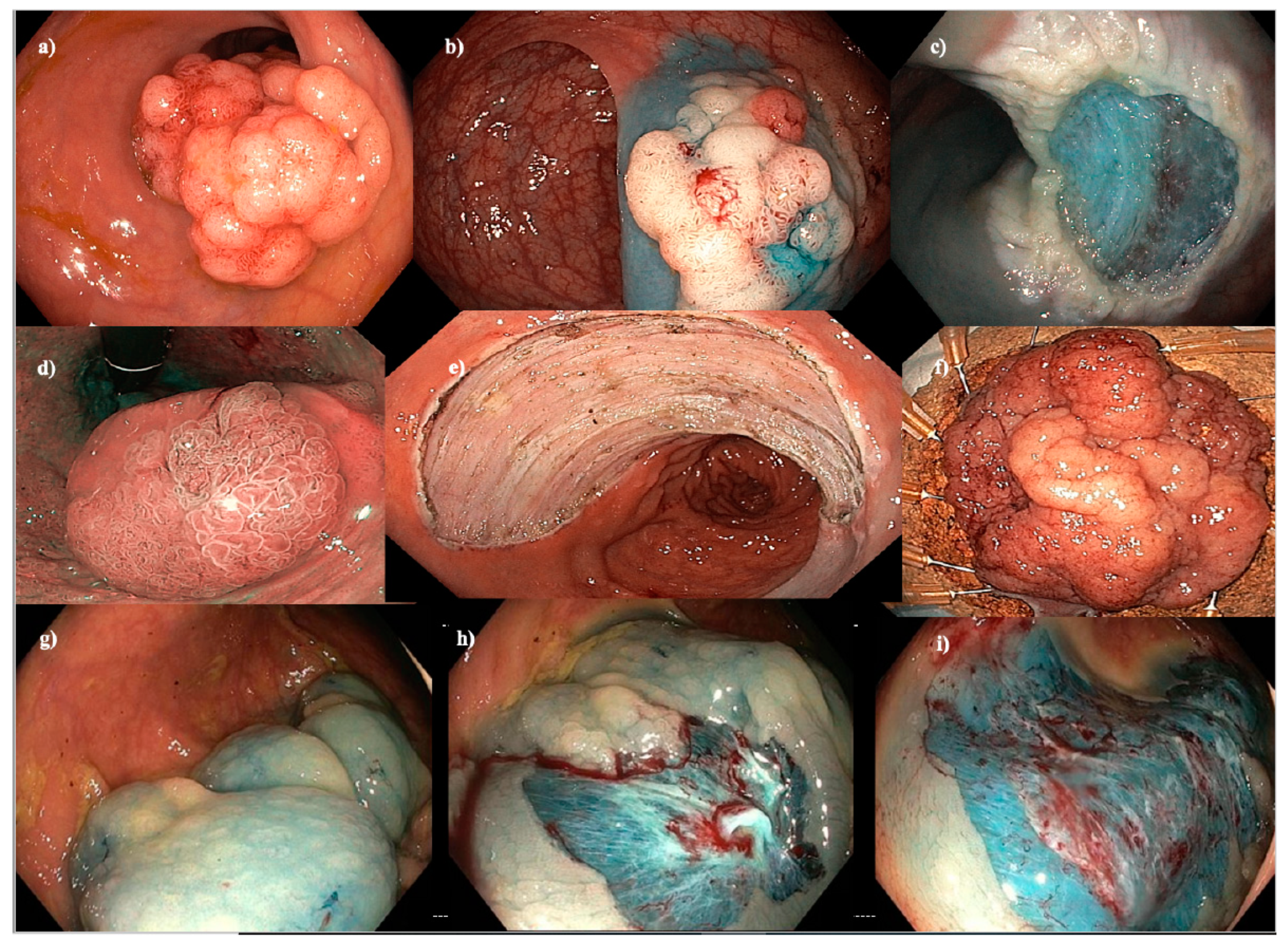 Cancers 15 03805 g001