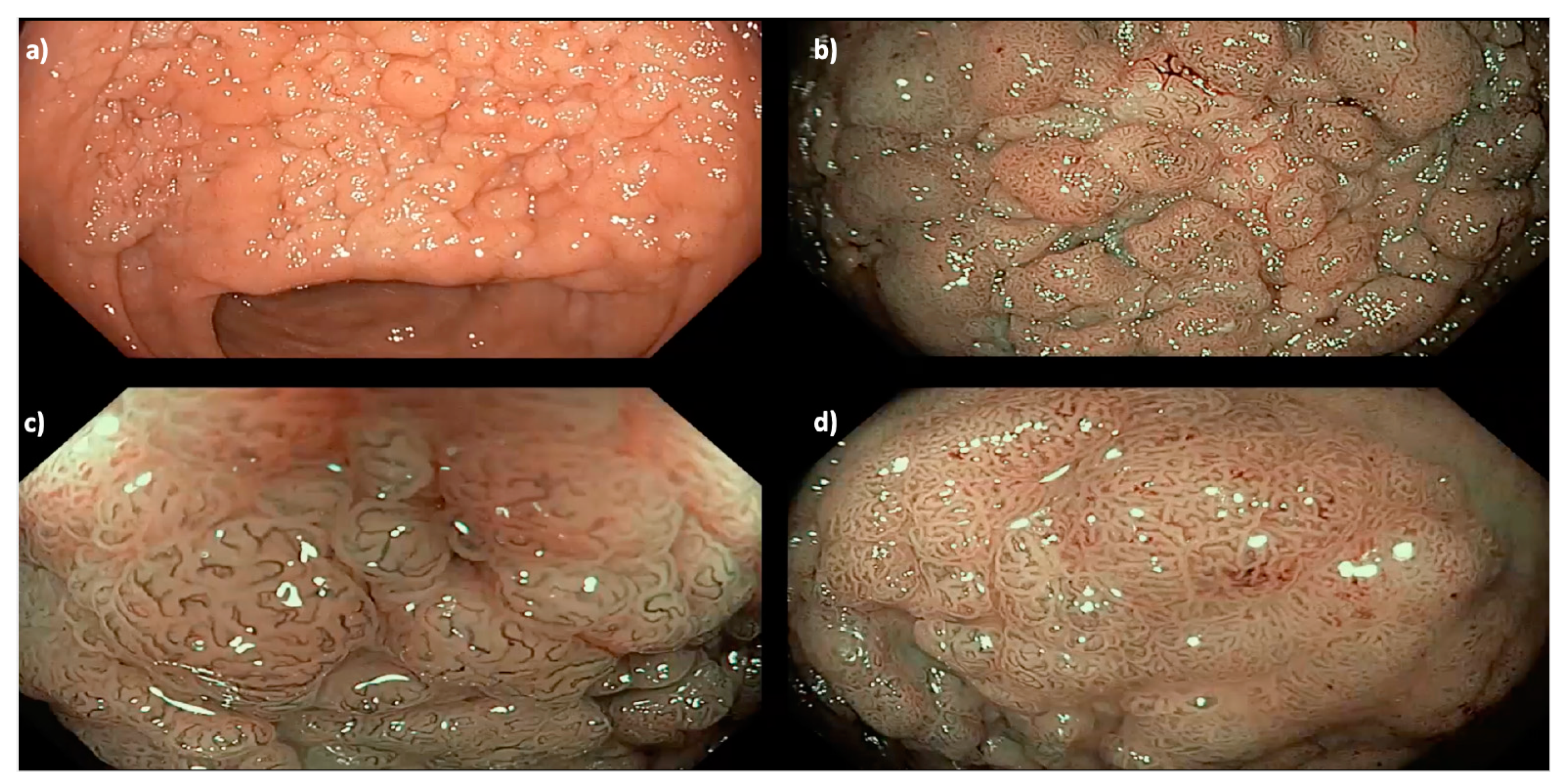 Cancers 15 03805 g002
