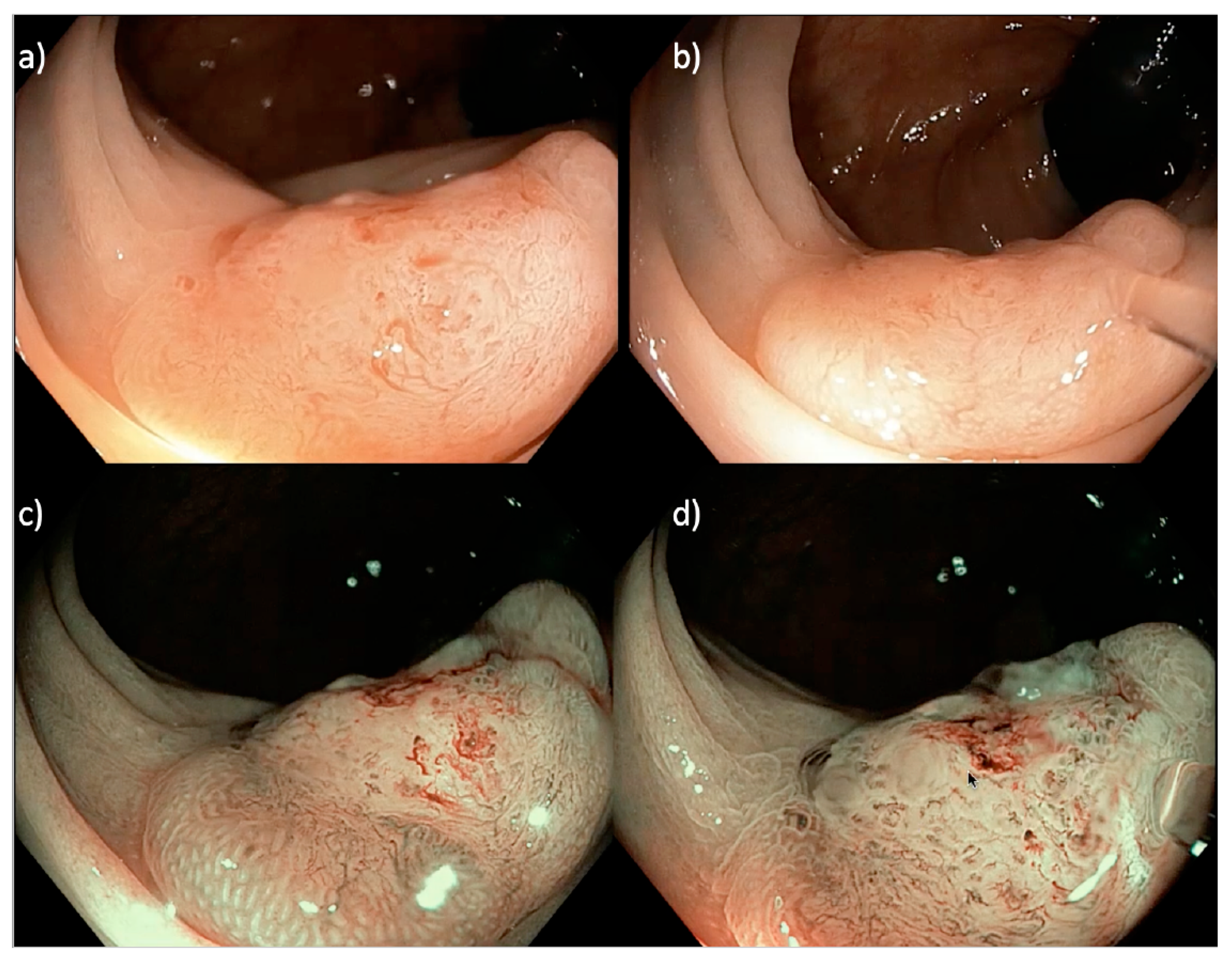 Cancers 15 03805 g003