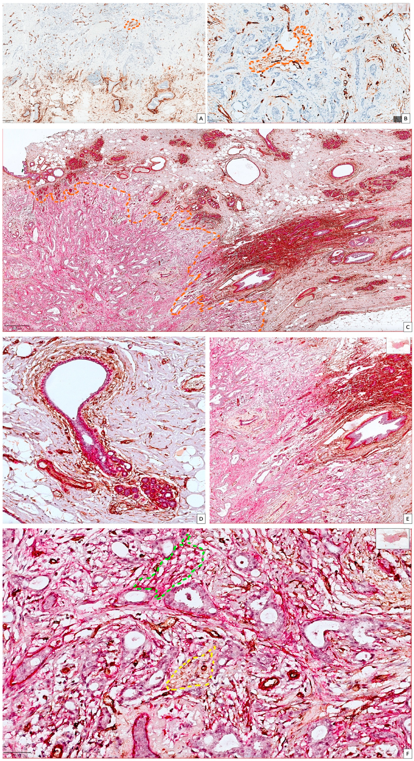 Cancers 15 03823 g002 Cancers 15 03823 g002