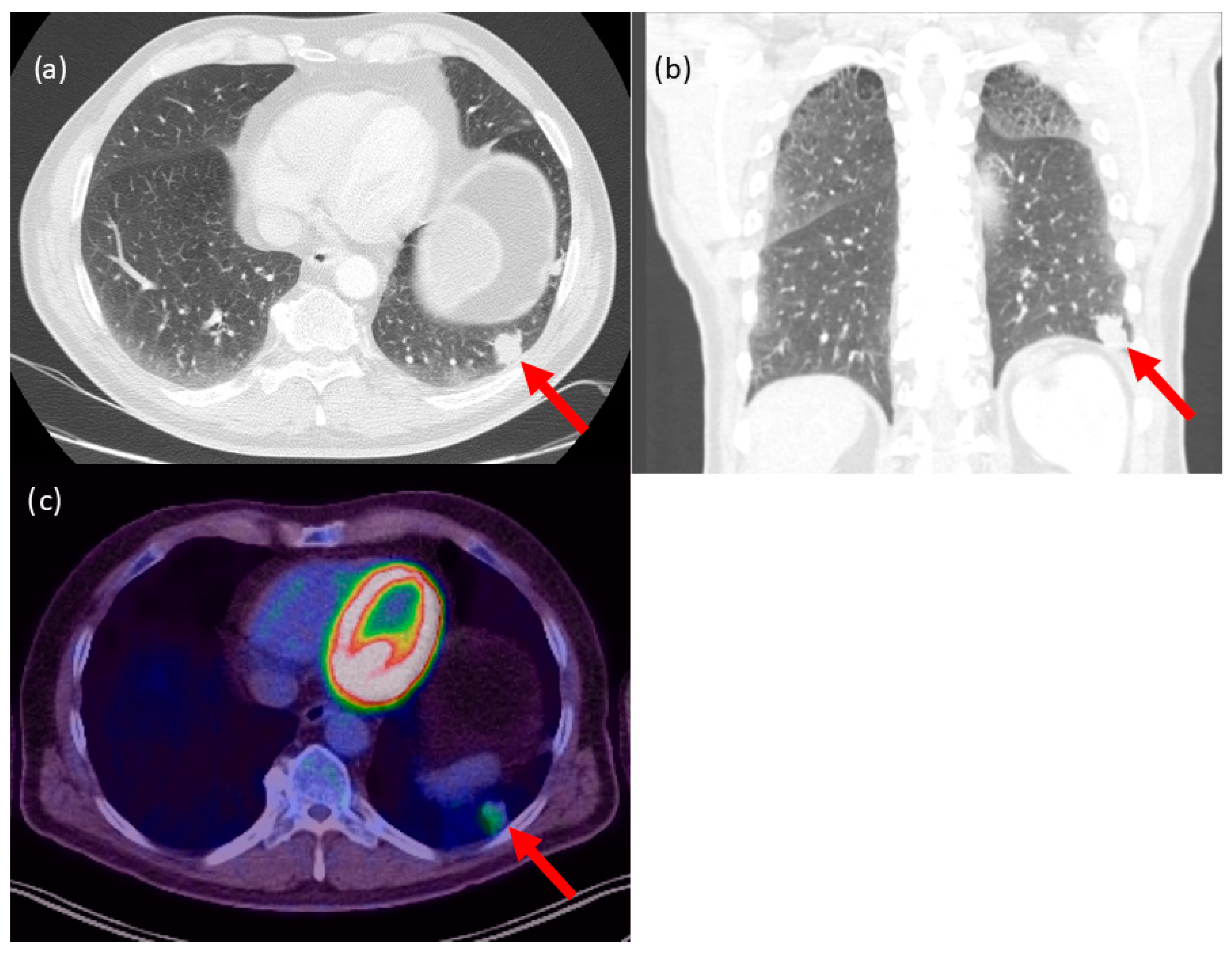 Cancers 15 03854 g001