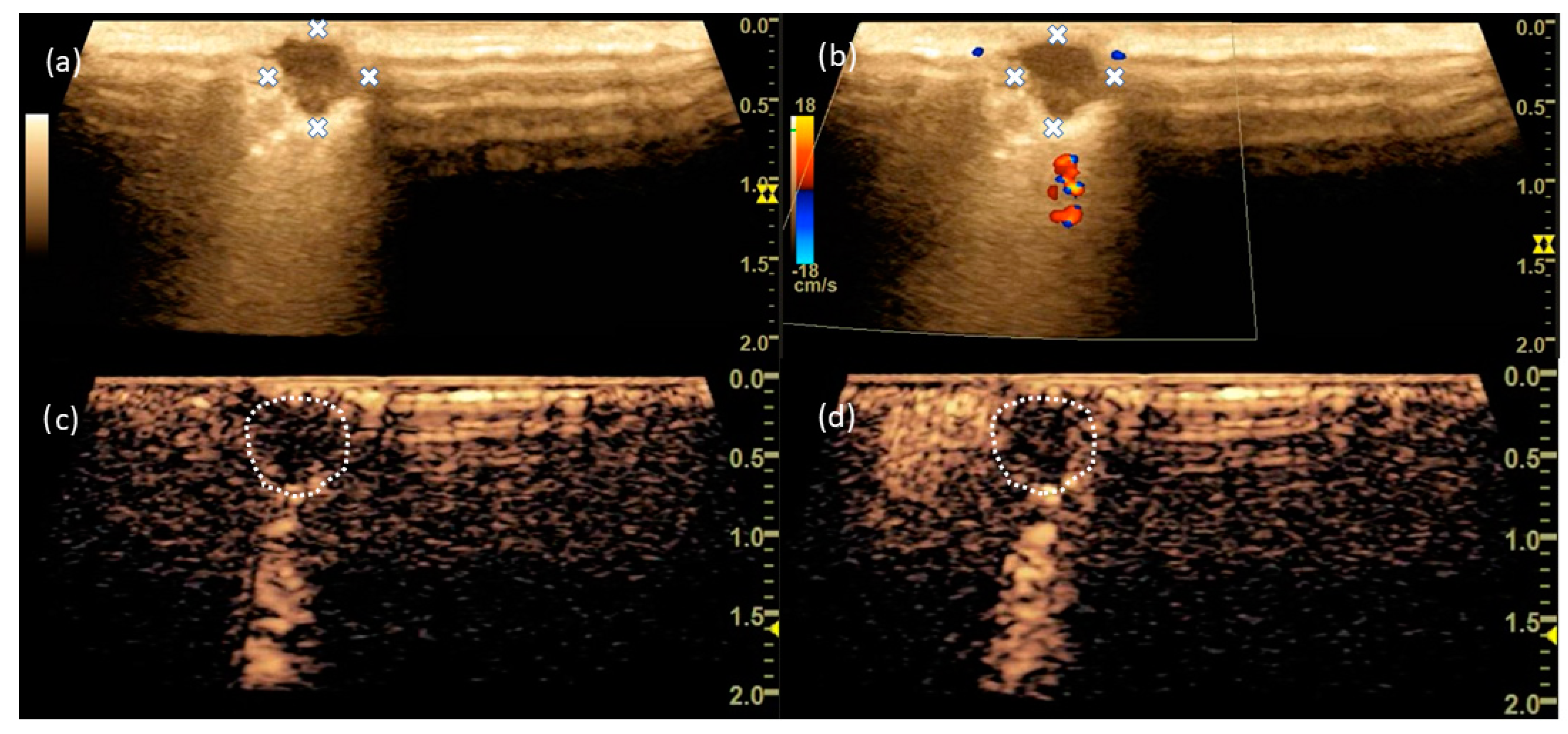 Cancers 15 03854 g004