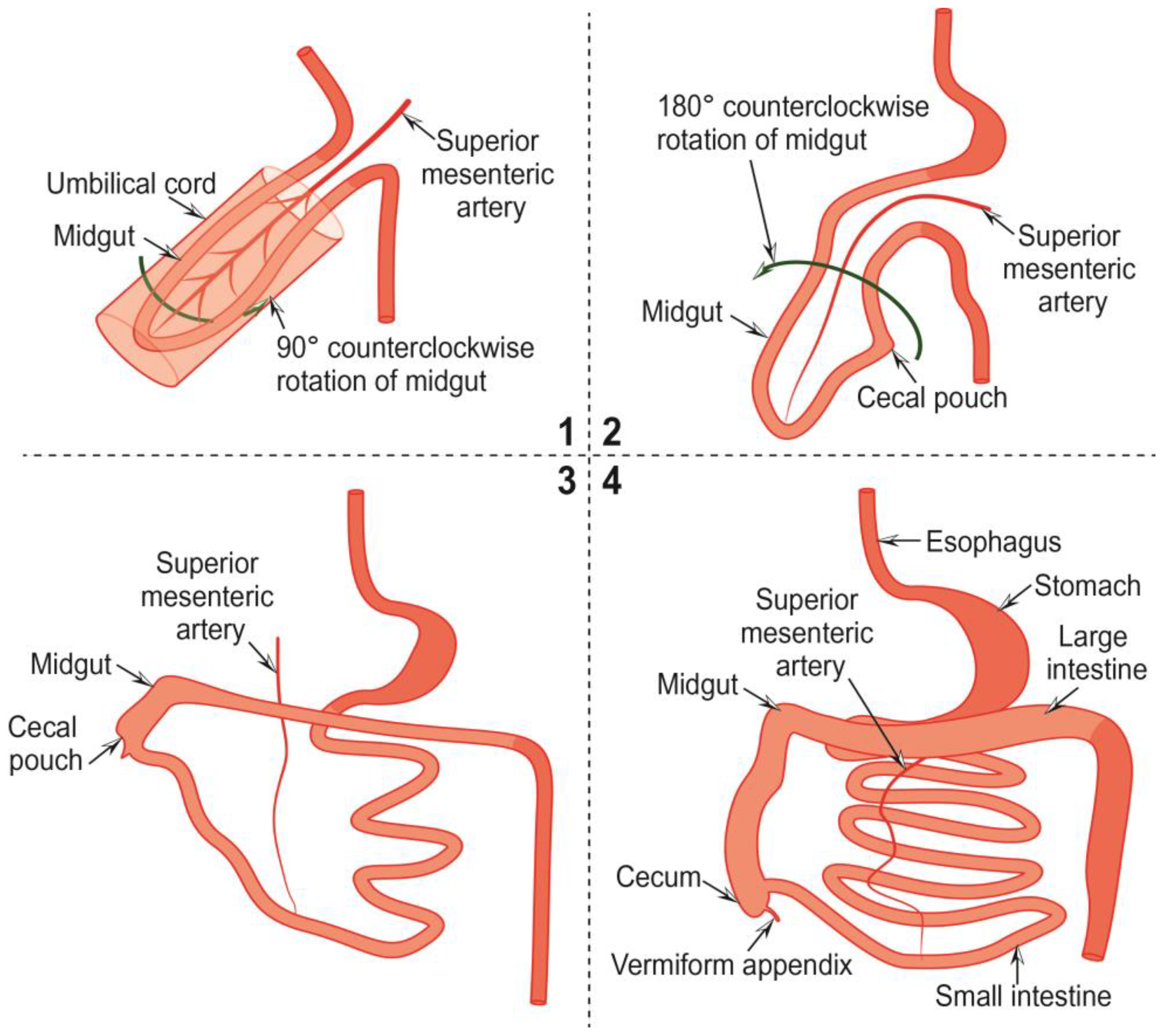 Cancers | Free Full-Text | The Vermiform Appendix and Its Pathologies