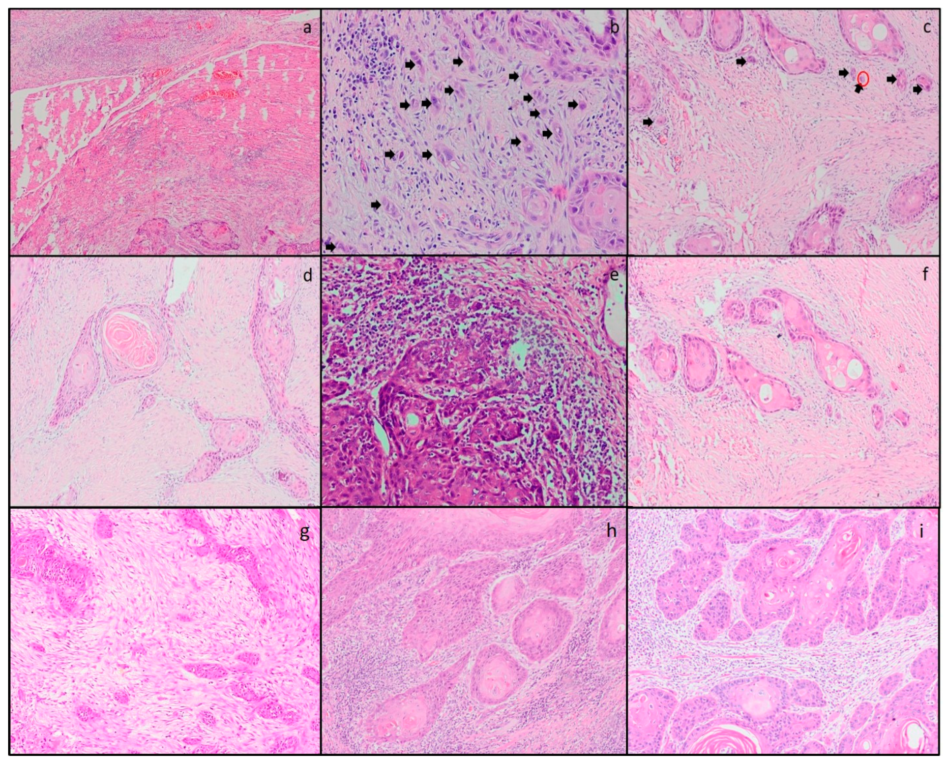 Cancers 15 03905 g001