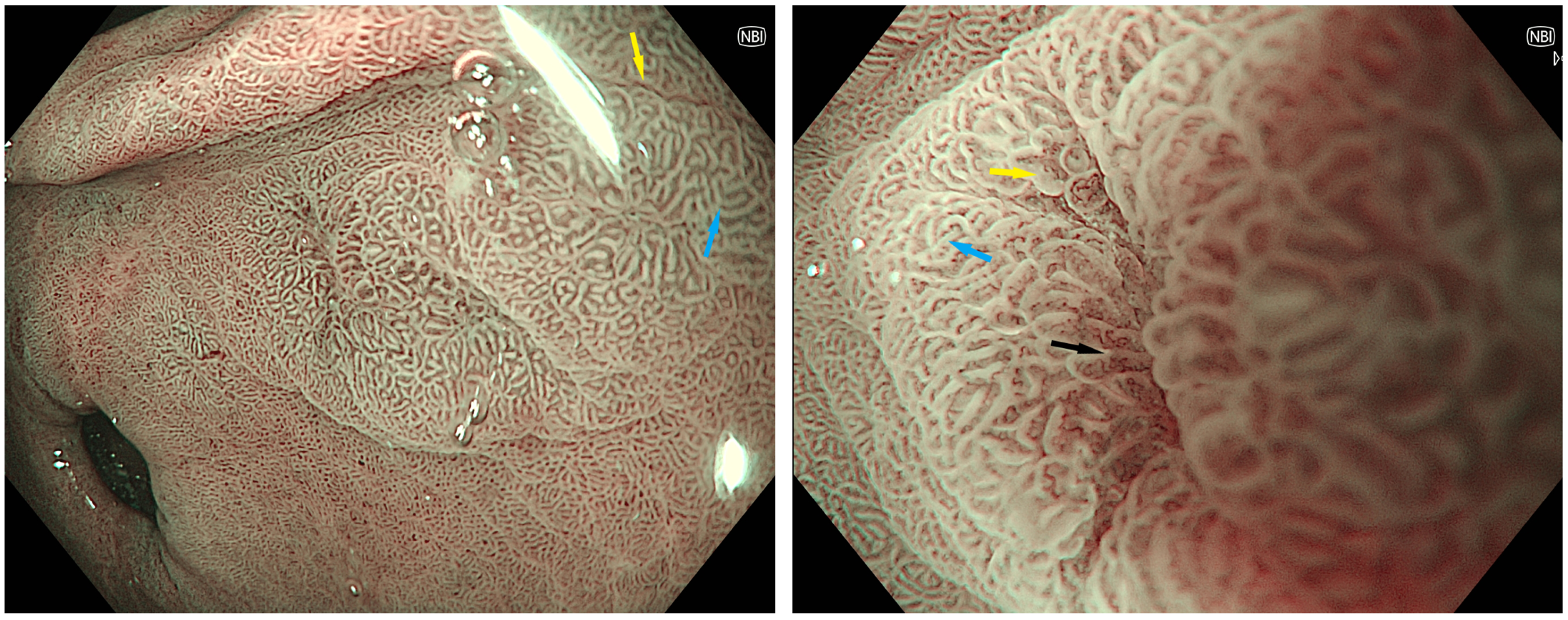 Cancers 15 03913 g002