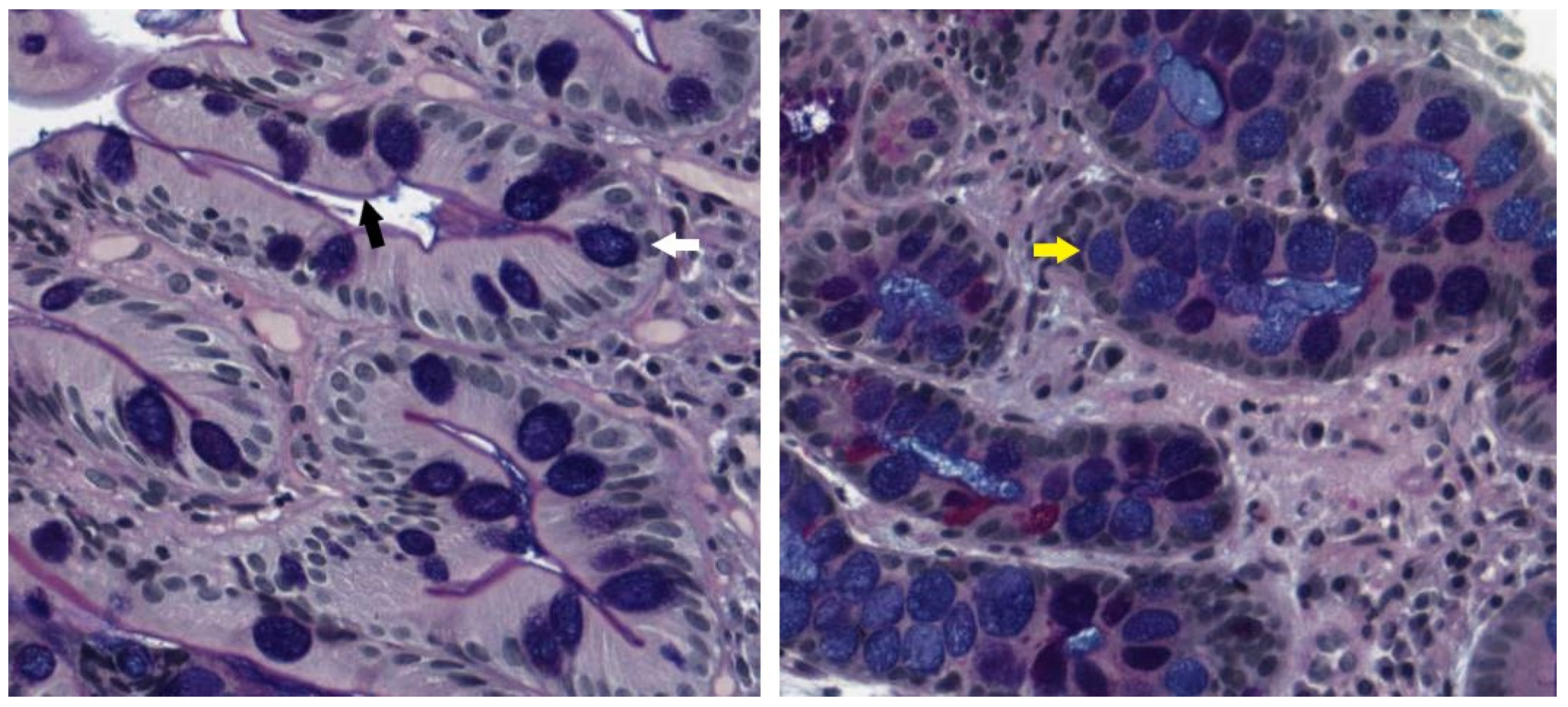 Cancers 15 03913 g003