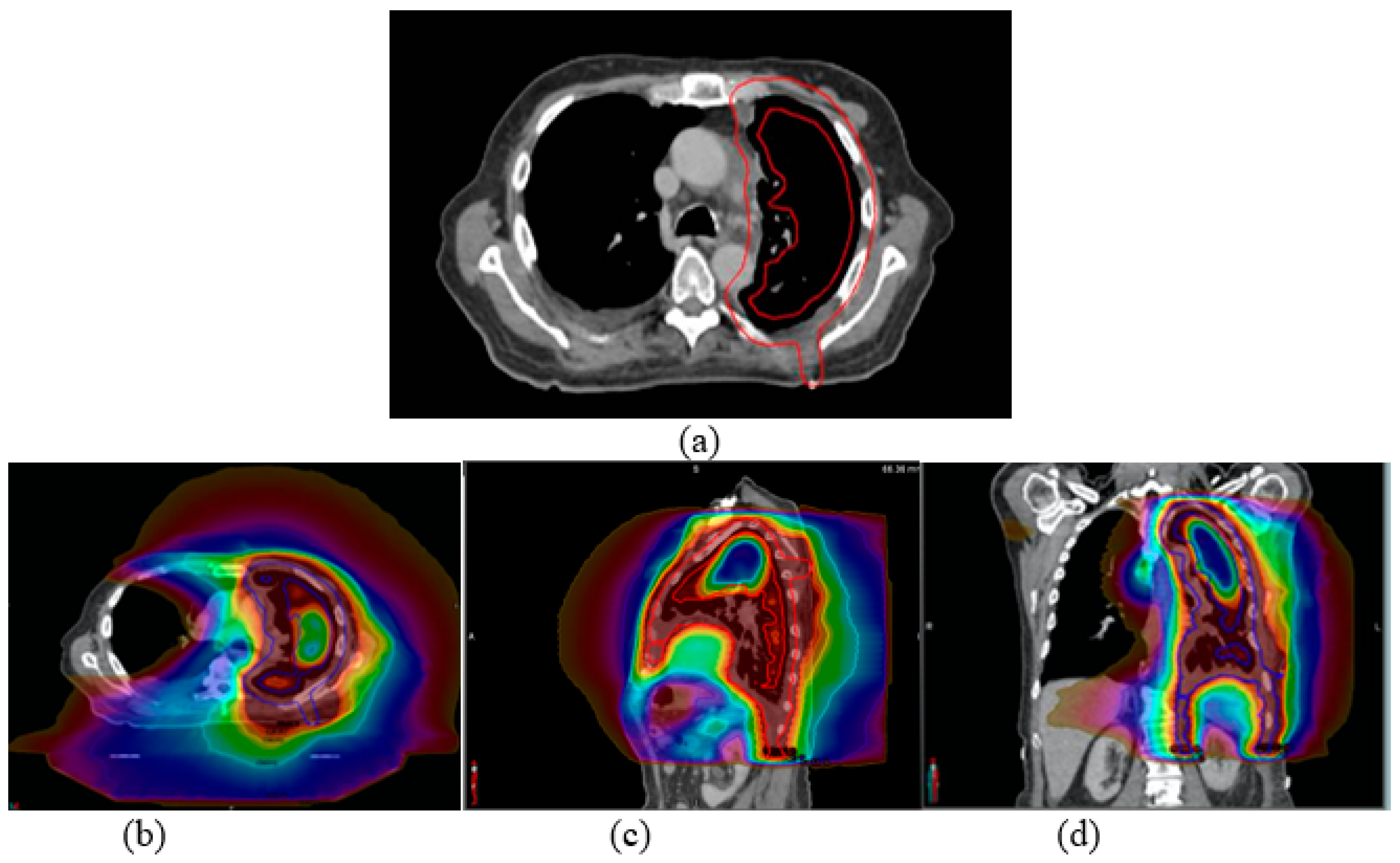 Cancers 15 03916 g001 Cancers 15 03916 g001