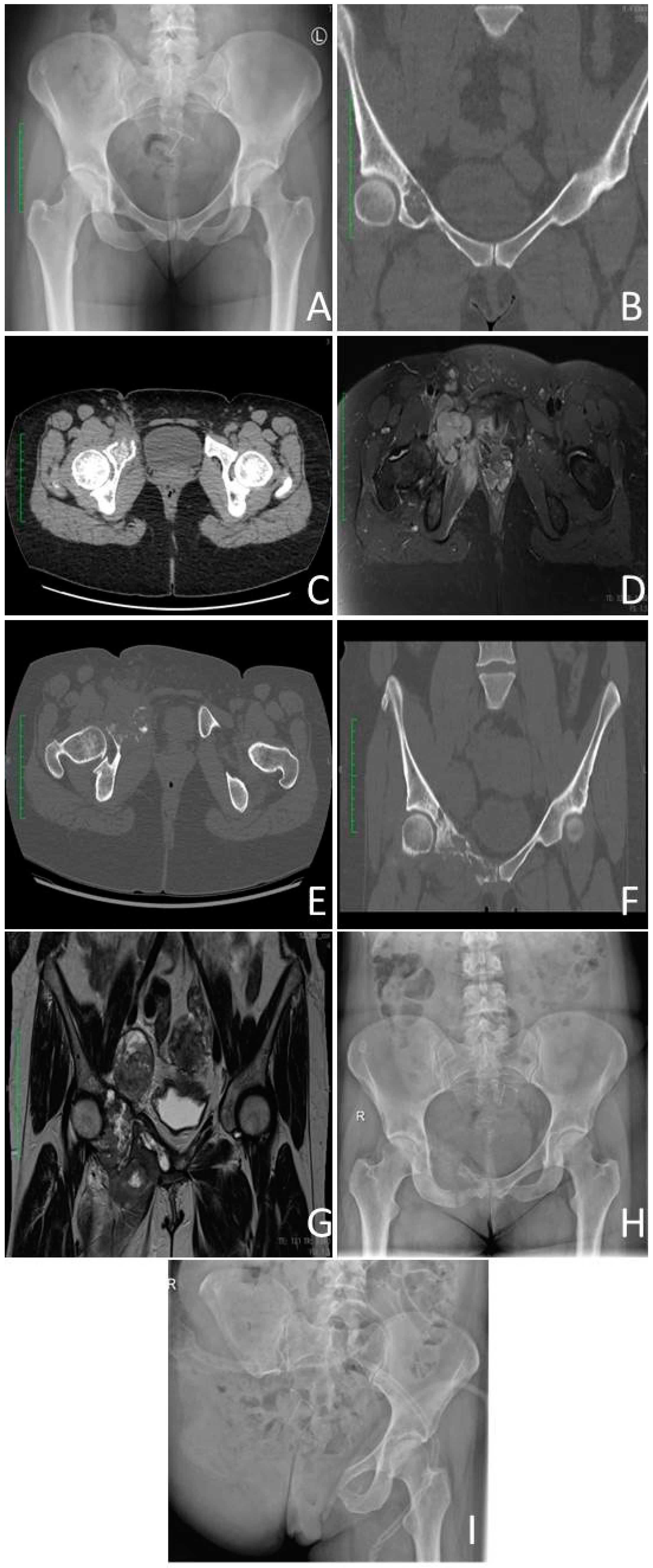 Cancers 15 03924 g001