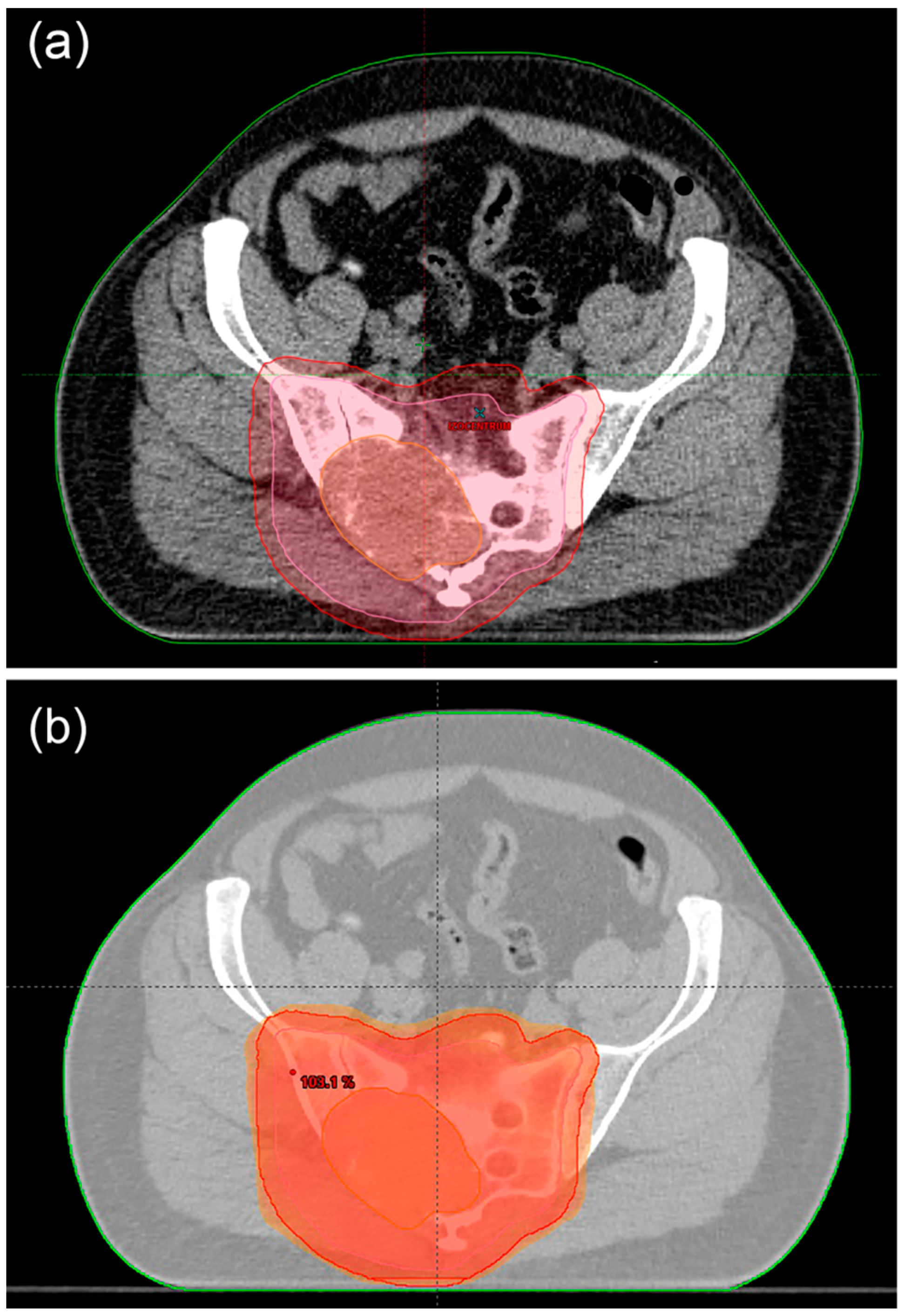 Cancers 15 03924 g005