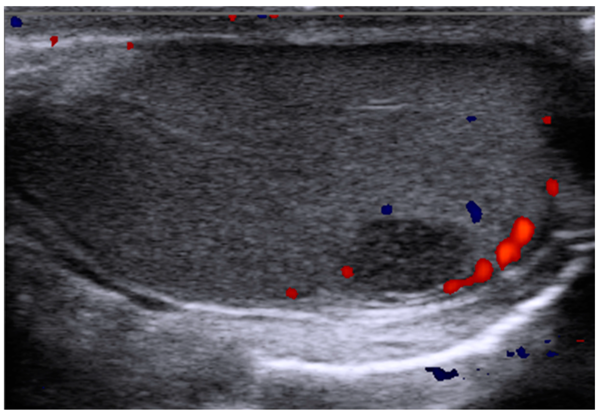 Cancers 15 03944 g001 Cancers 15 03944 g001