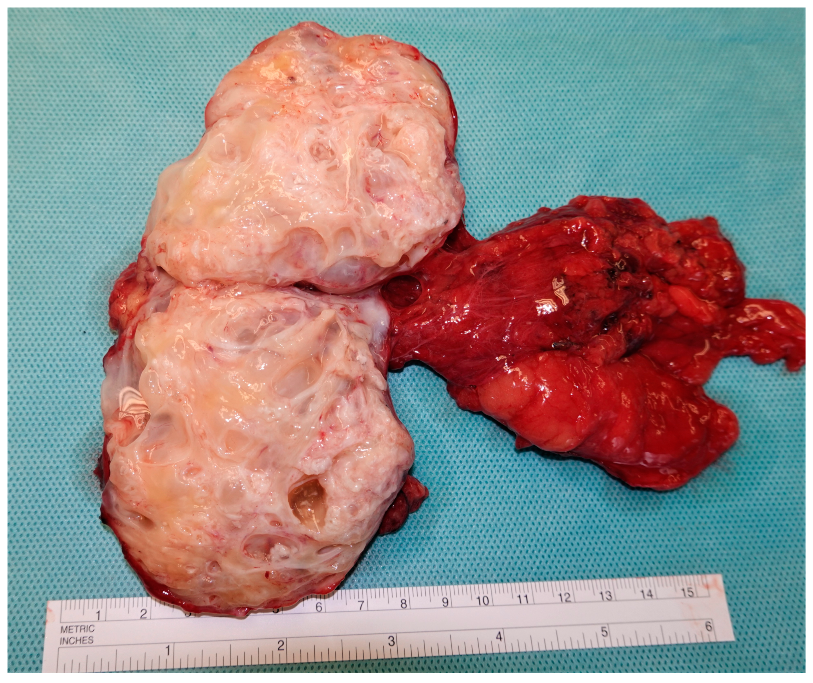 Cancers 15 03944 g005 Cancers 15 03944 g005