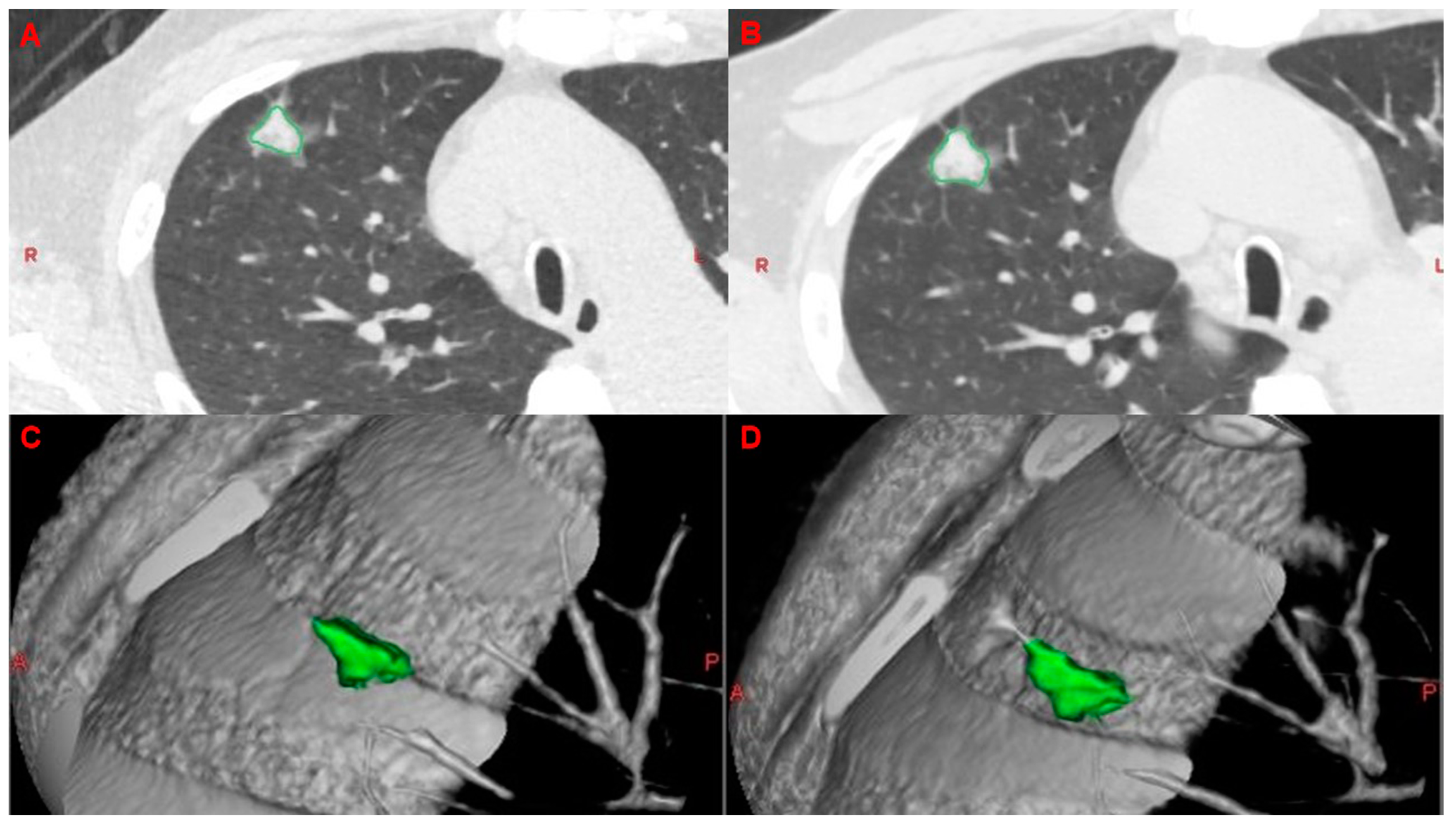 Cancers 15 03952 g001