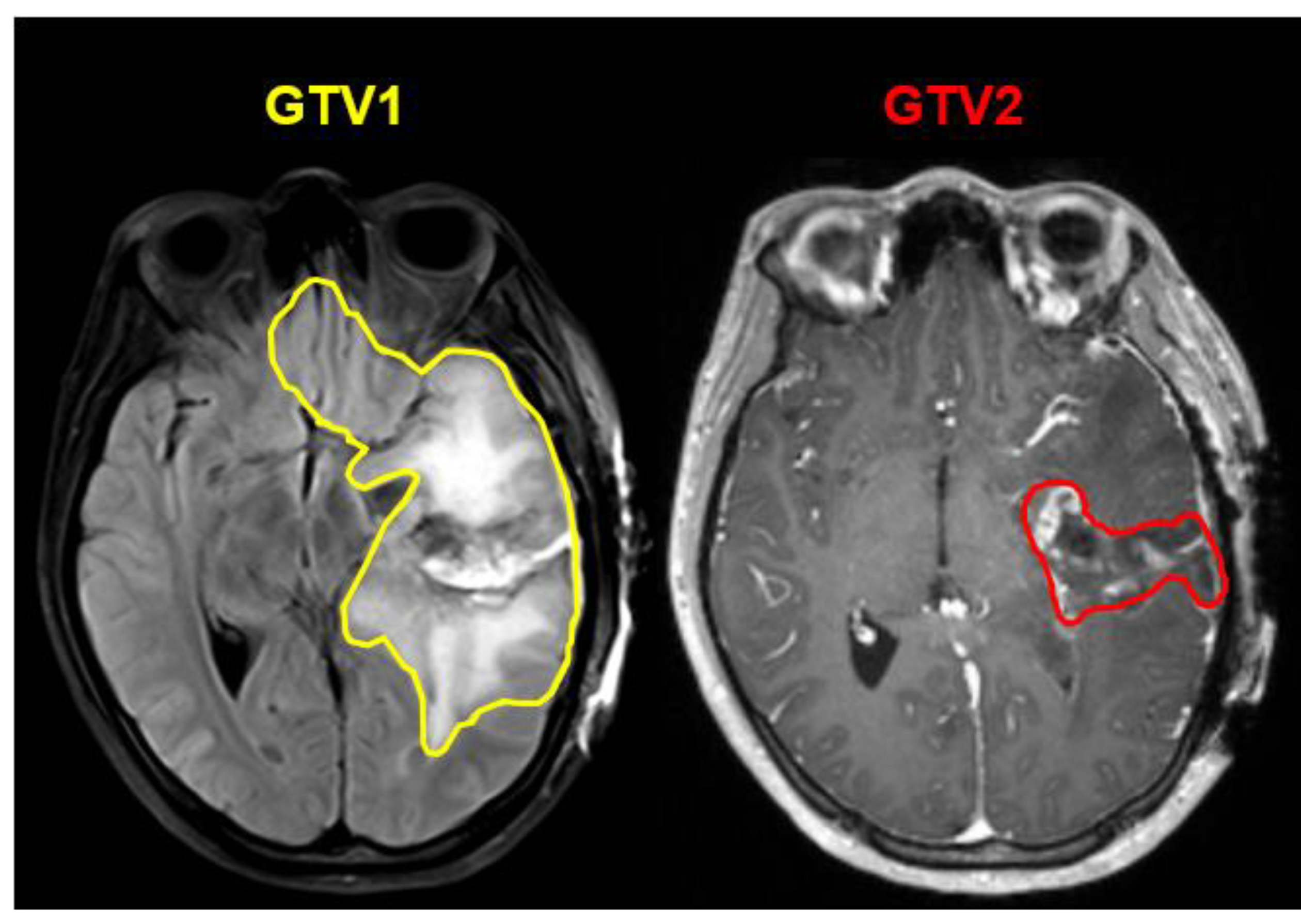 Cancers 15 03956 g002 Cancers 15 03956 g002