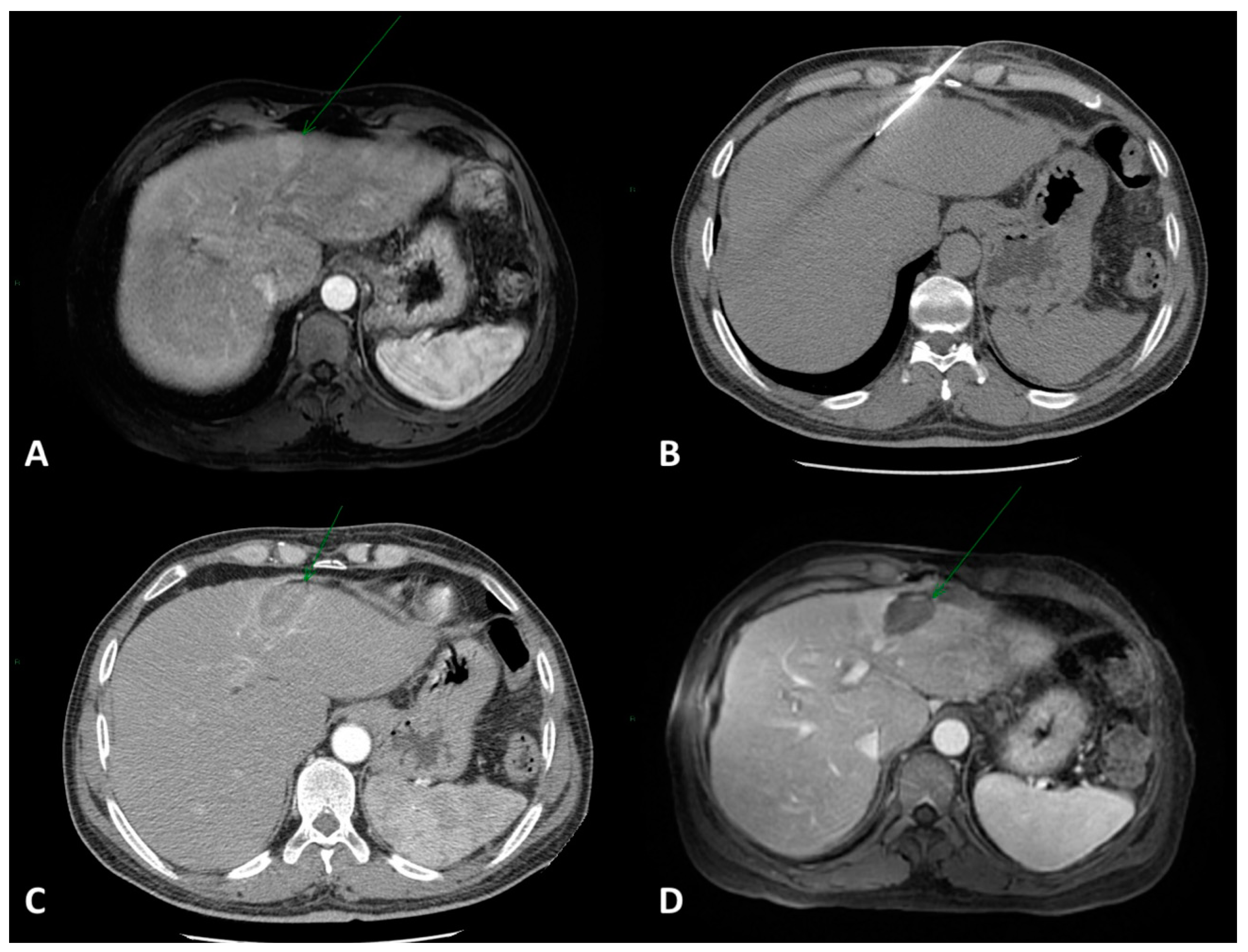 Cancers 15 03988 g001