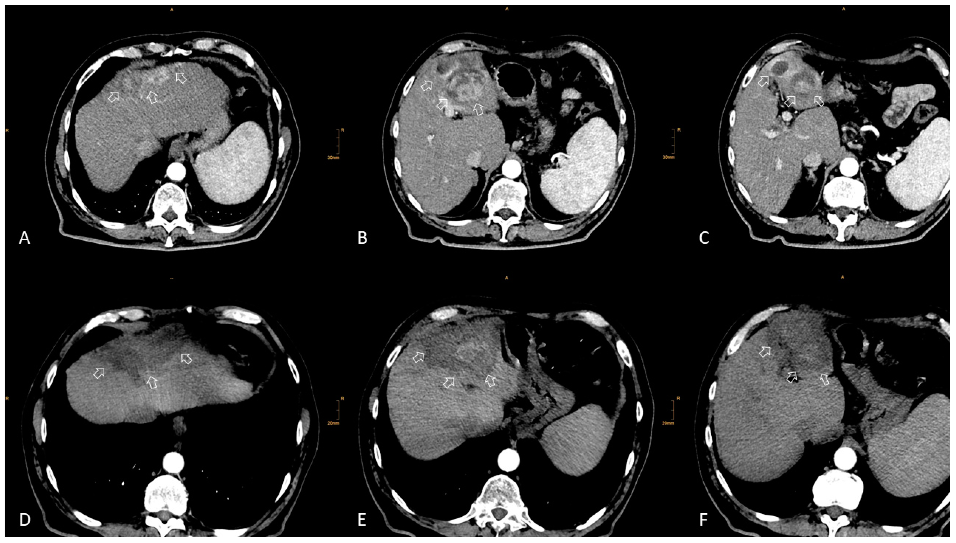 Cancers 15 03988 g002