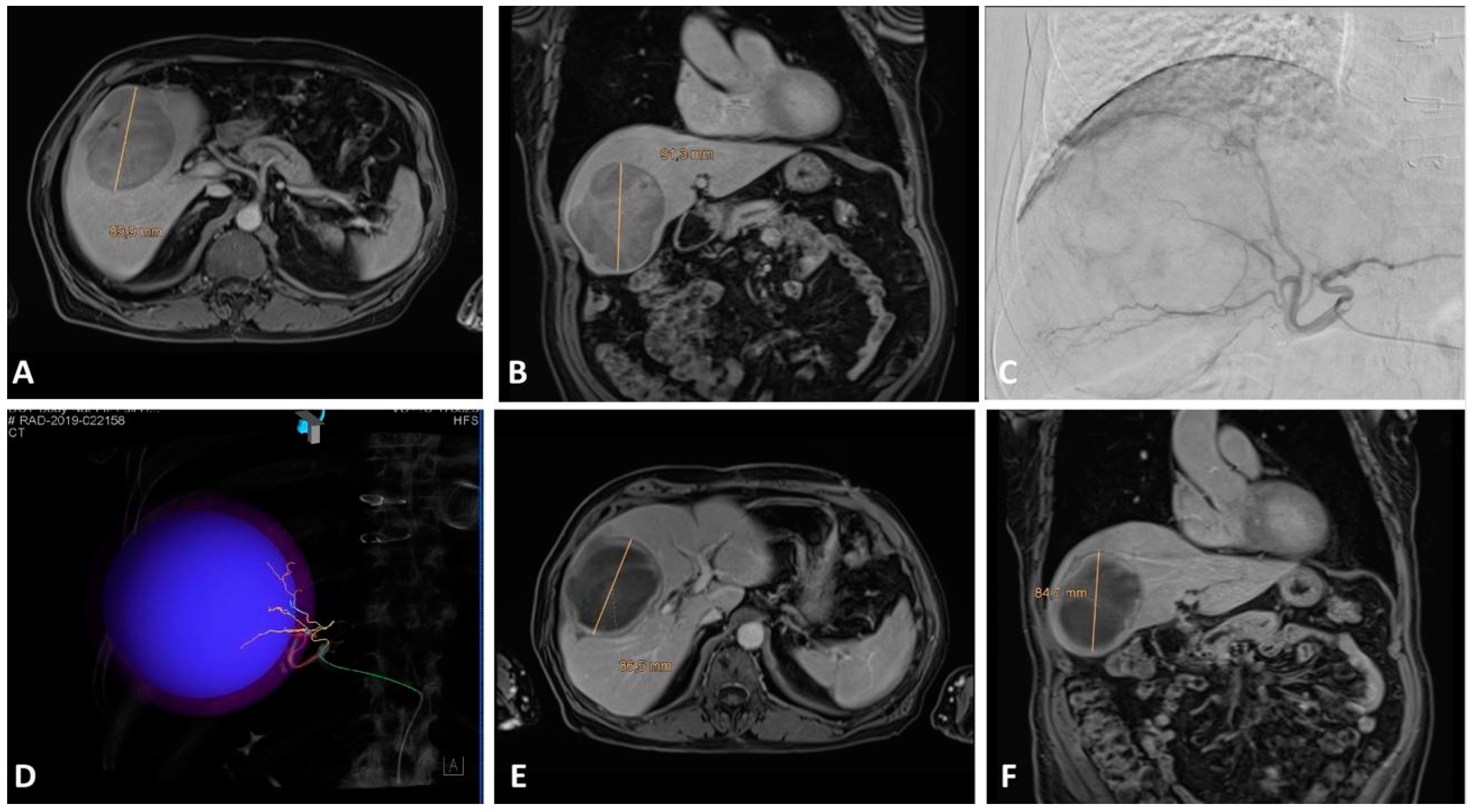 Cancers 15 03988 g003