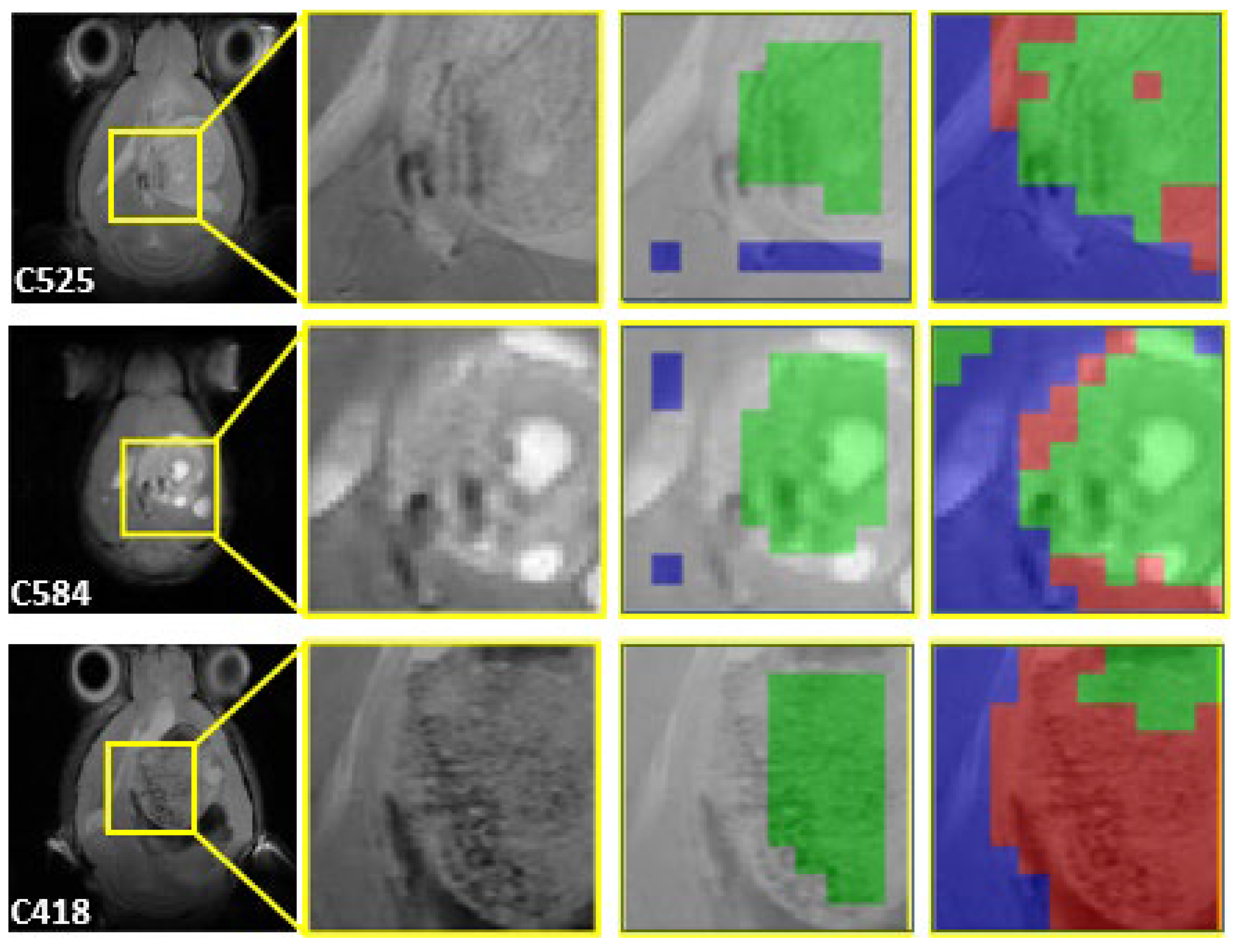 Cancers 15 04002 g004 Cancers 15 04002 g004