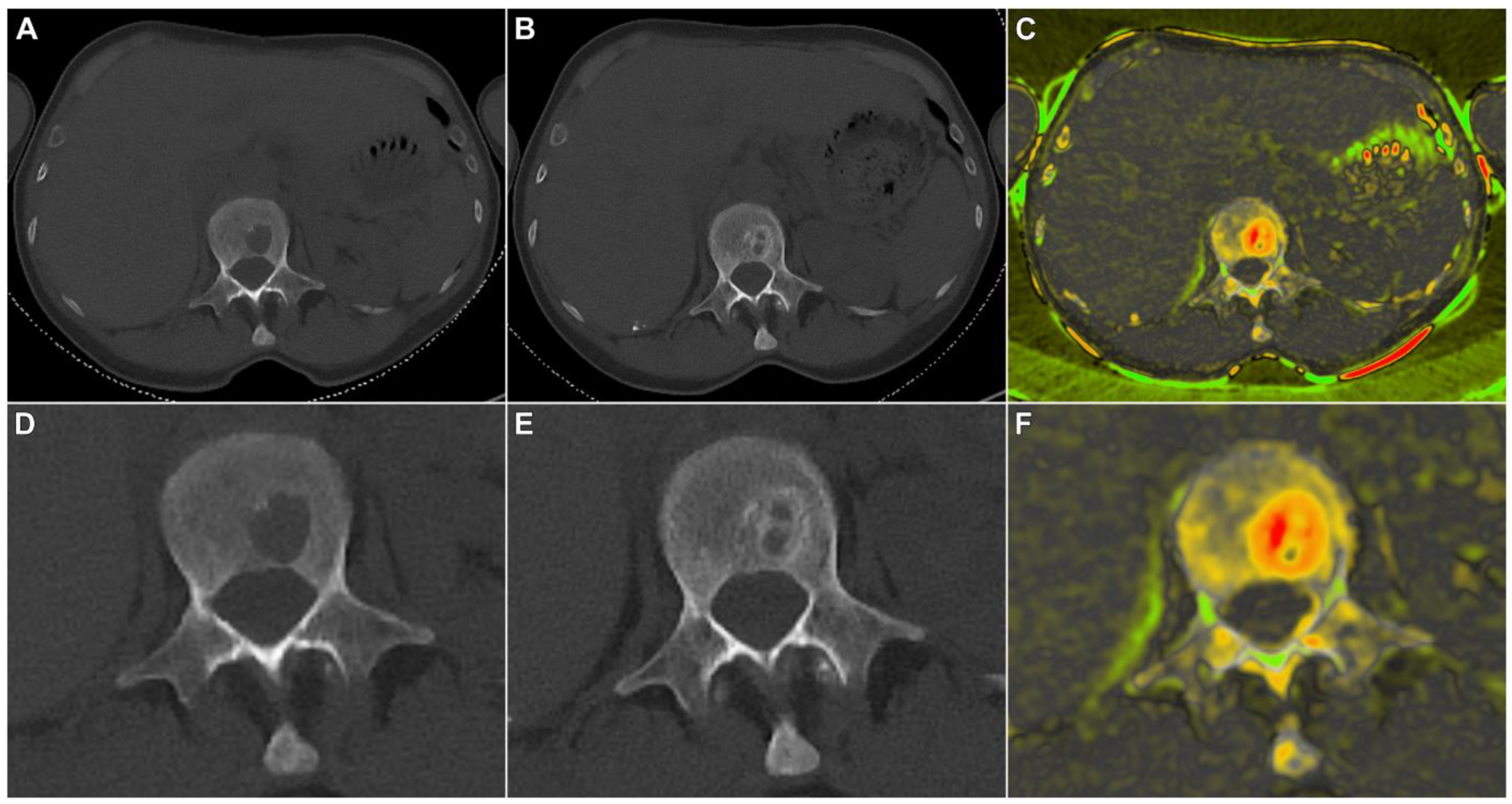 Cancers 15 04008 g004