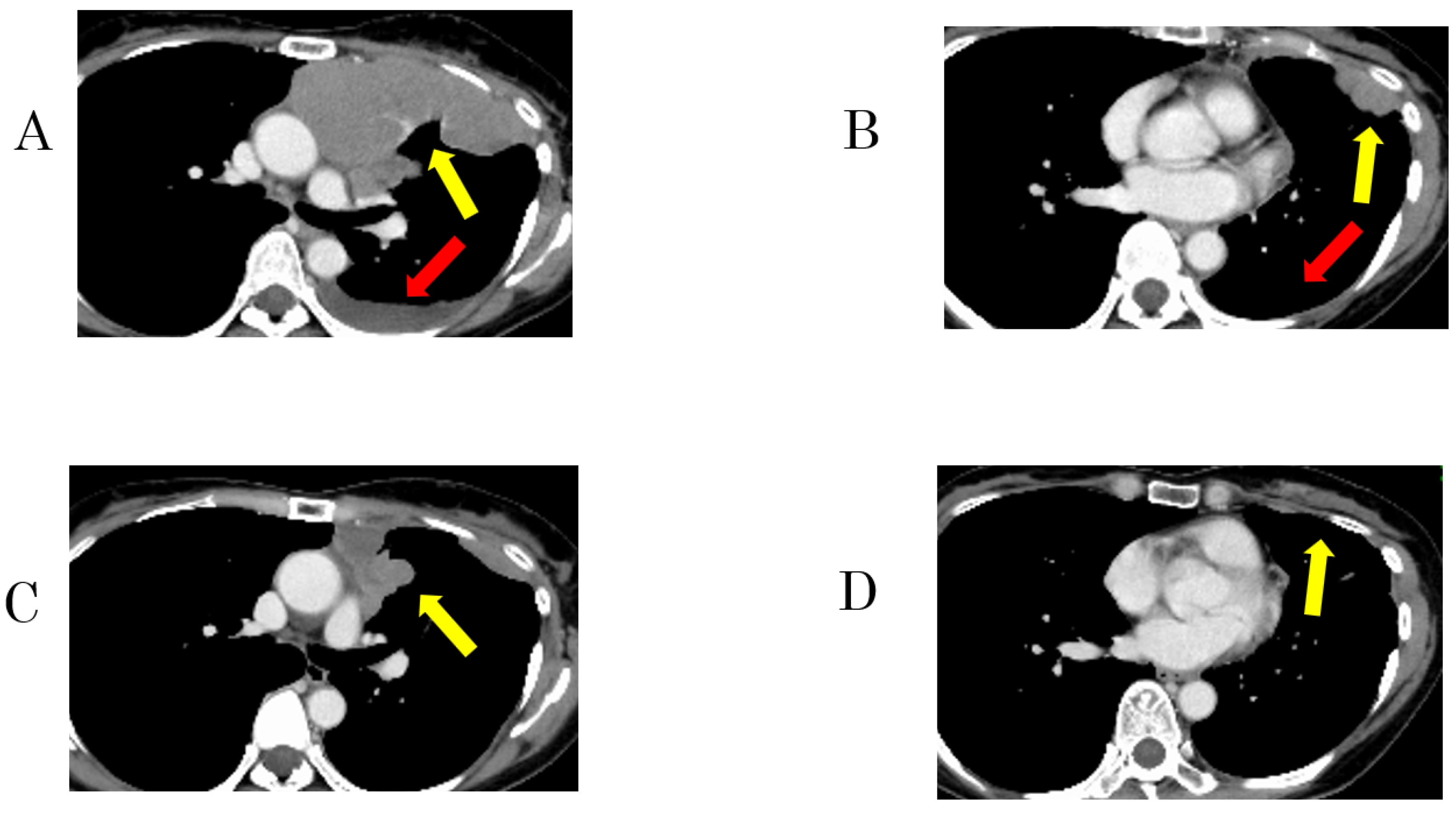 Cancers 15 04018 g002 Cancers 15 04018 g002