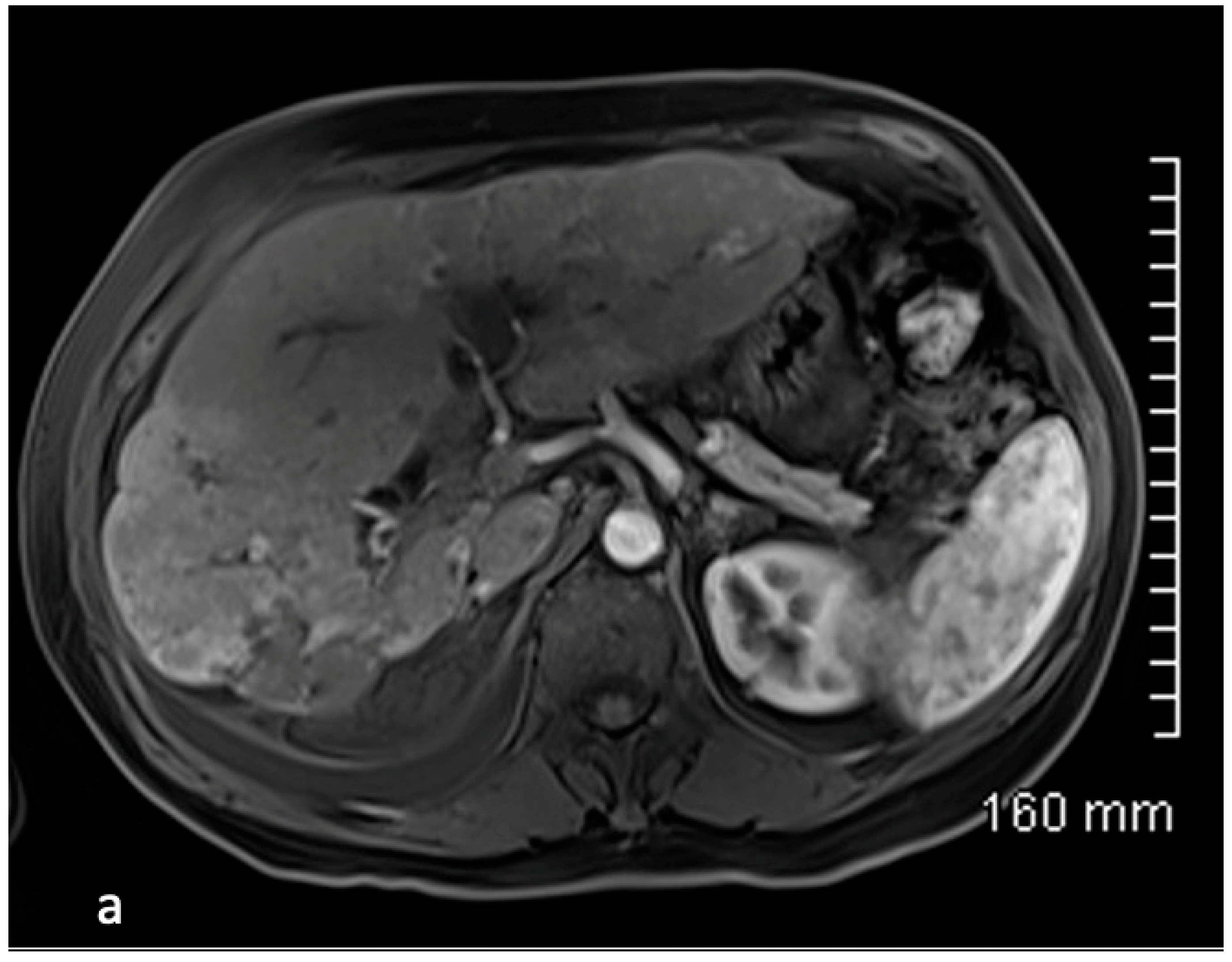 Cancers 15 04021 g006a Cancers 15 04021 g006a