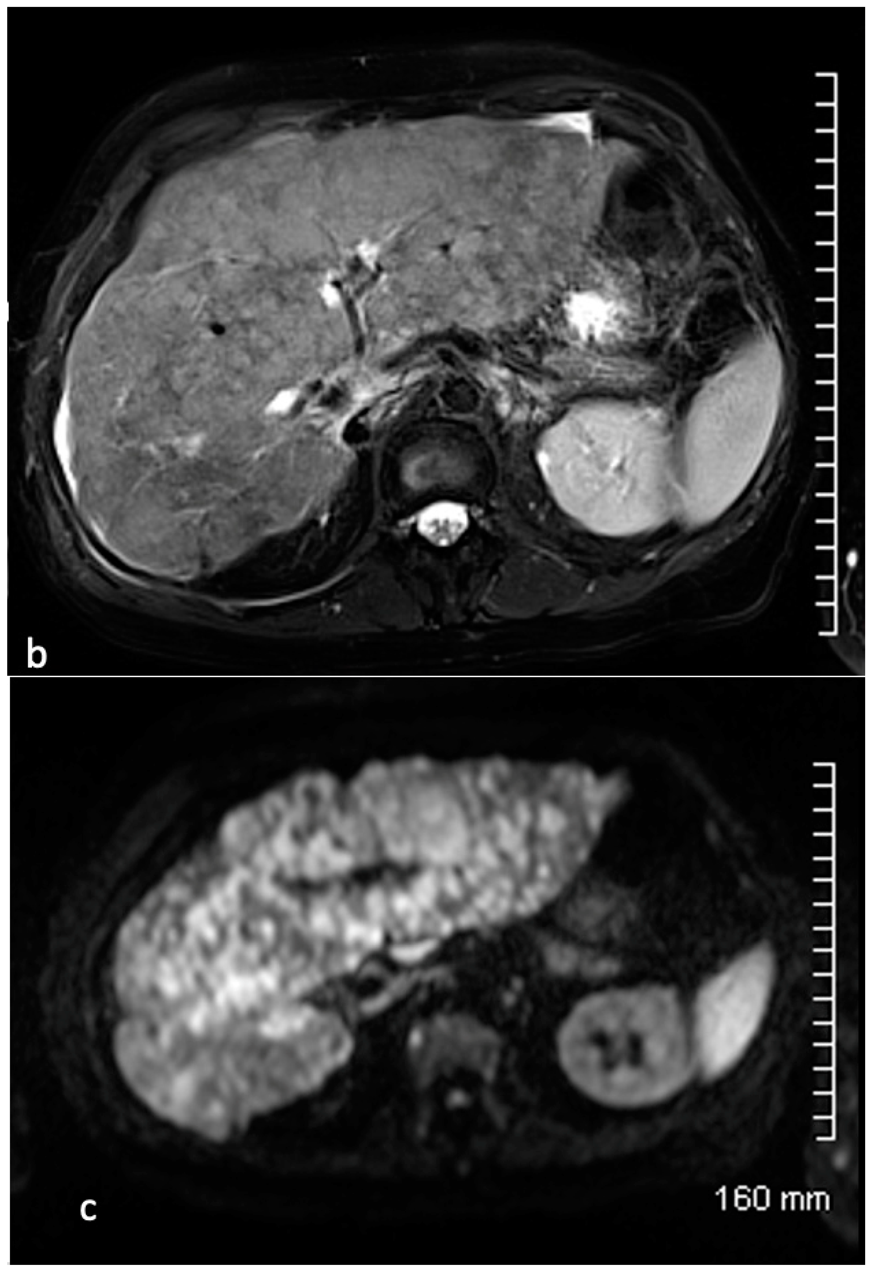 Cancers 15 04021 g006b Cancers 15 04021 g006b