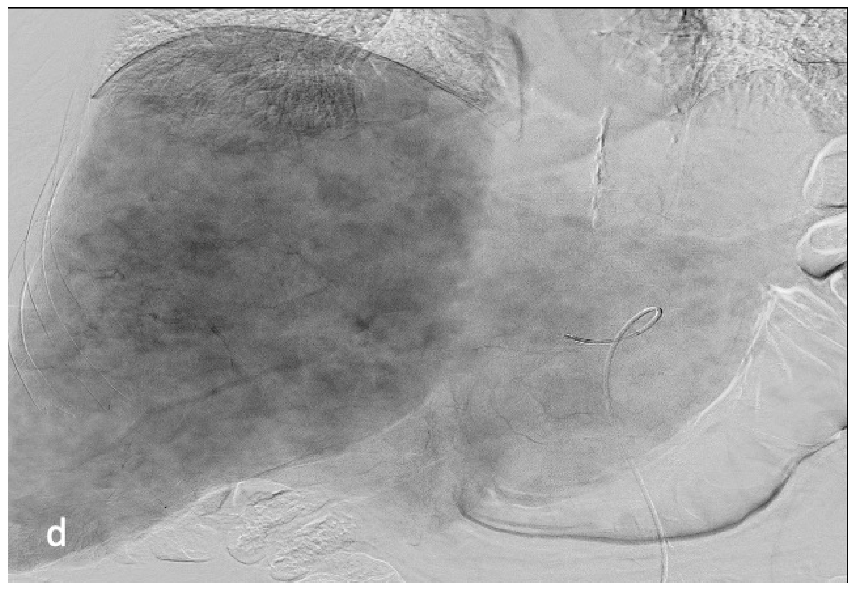 Cancers 15 04021 g006c Cancers 15 04021 g006c