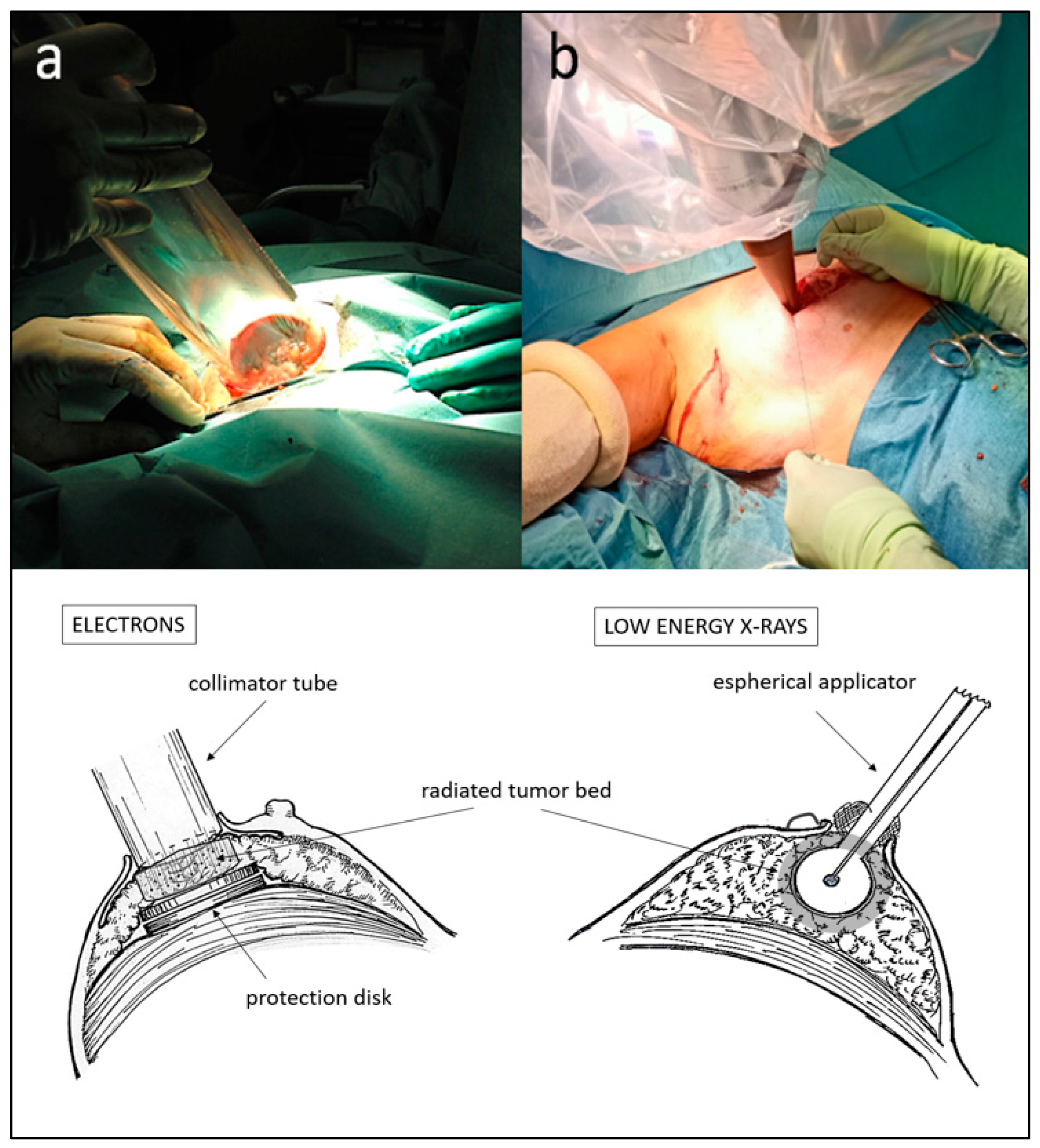 Cancers 15 04025 g002